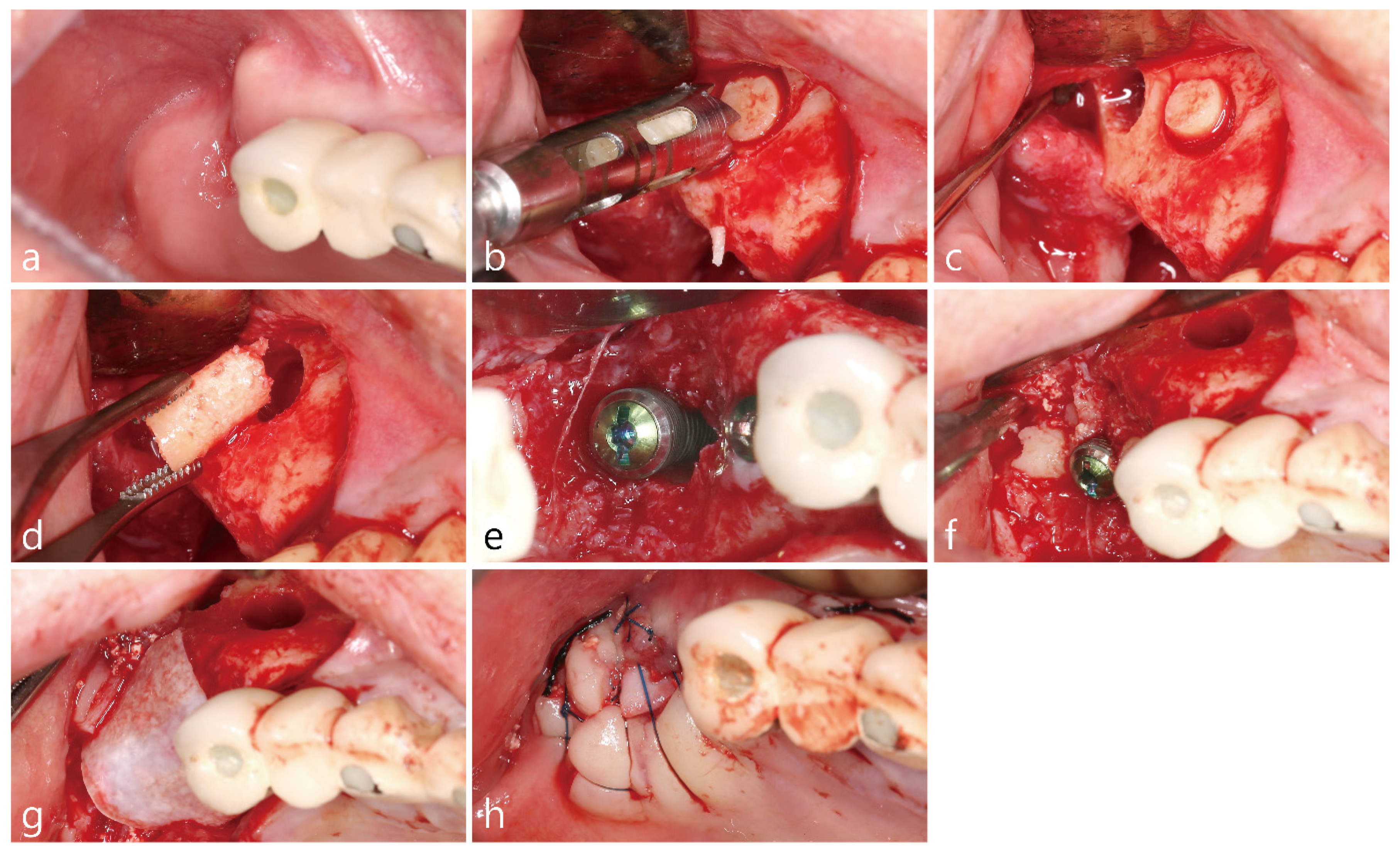 Medicina 58 00598 g002 550