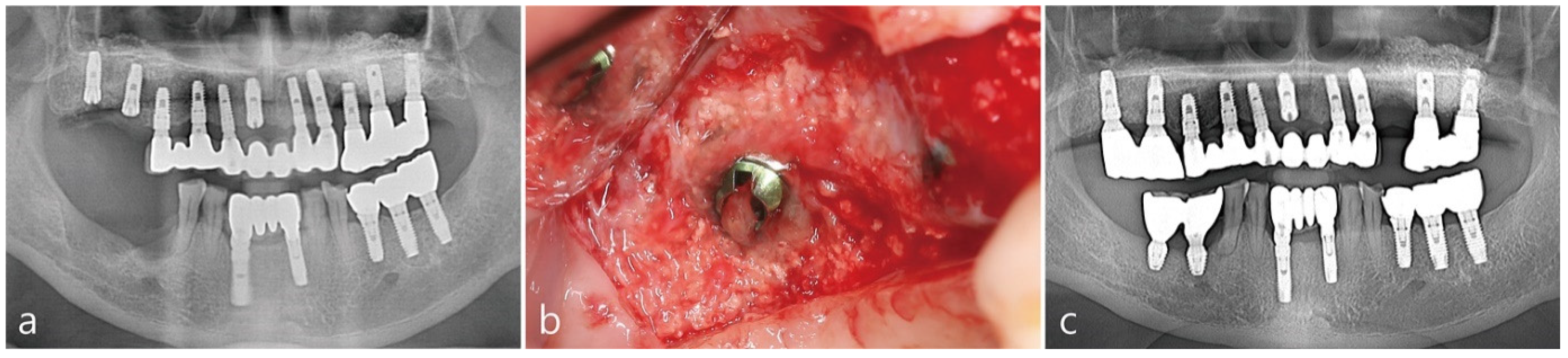 Medicina 58 00598 g004 550