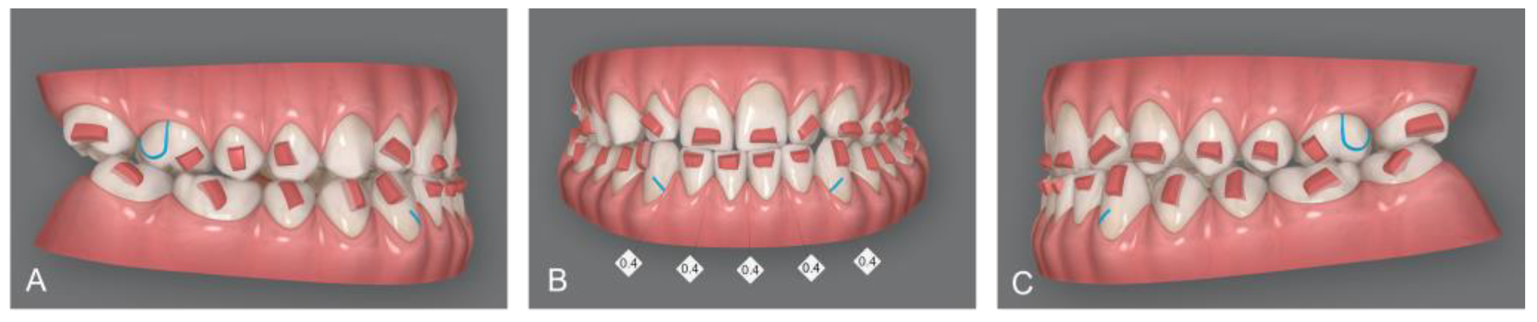 Medicina 58 00603 g004
