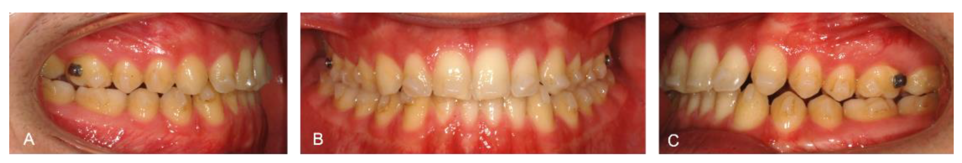 Medicina 58 00603 g005