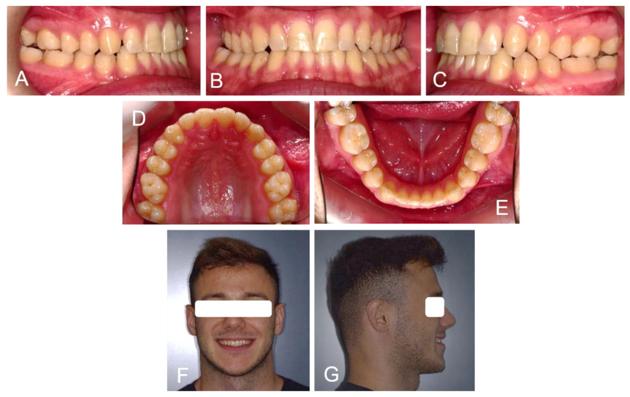 Medicina 58 00603 g006
