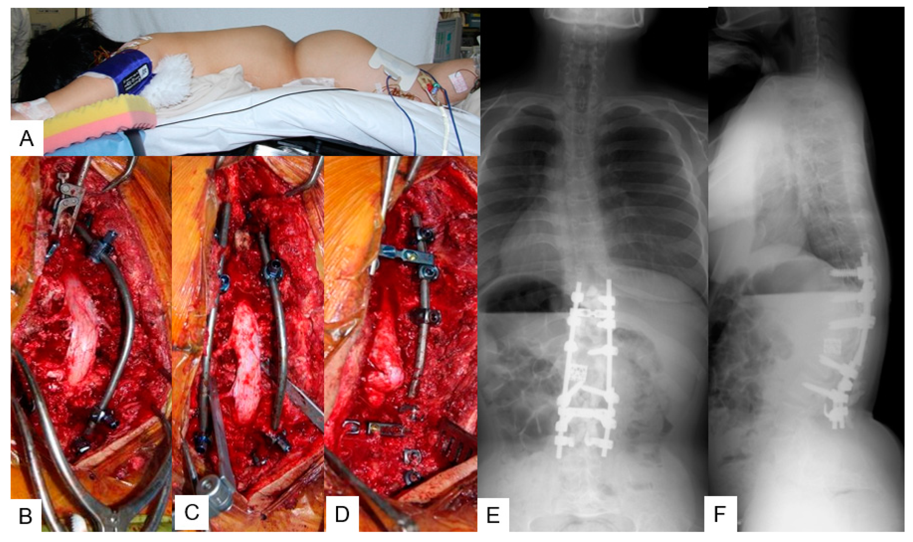 Medicina 58 00605 g004 550