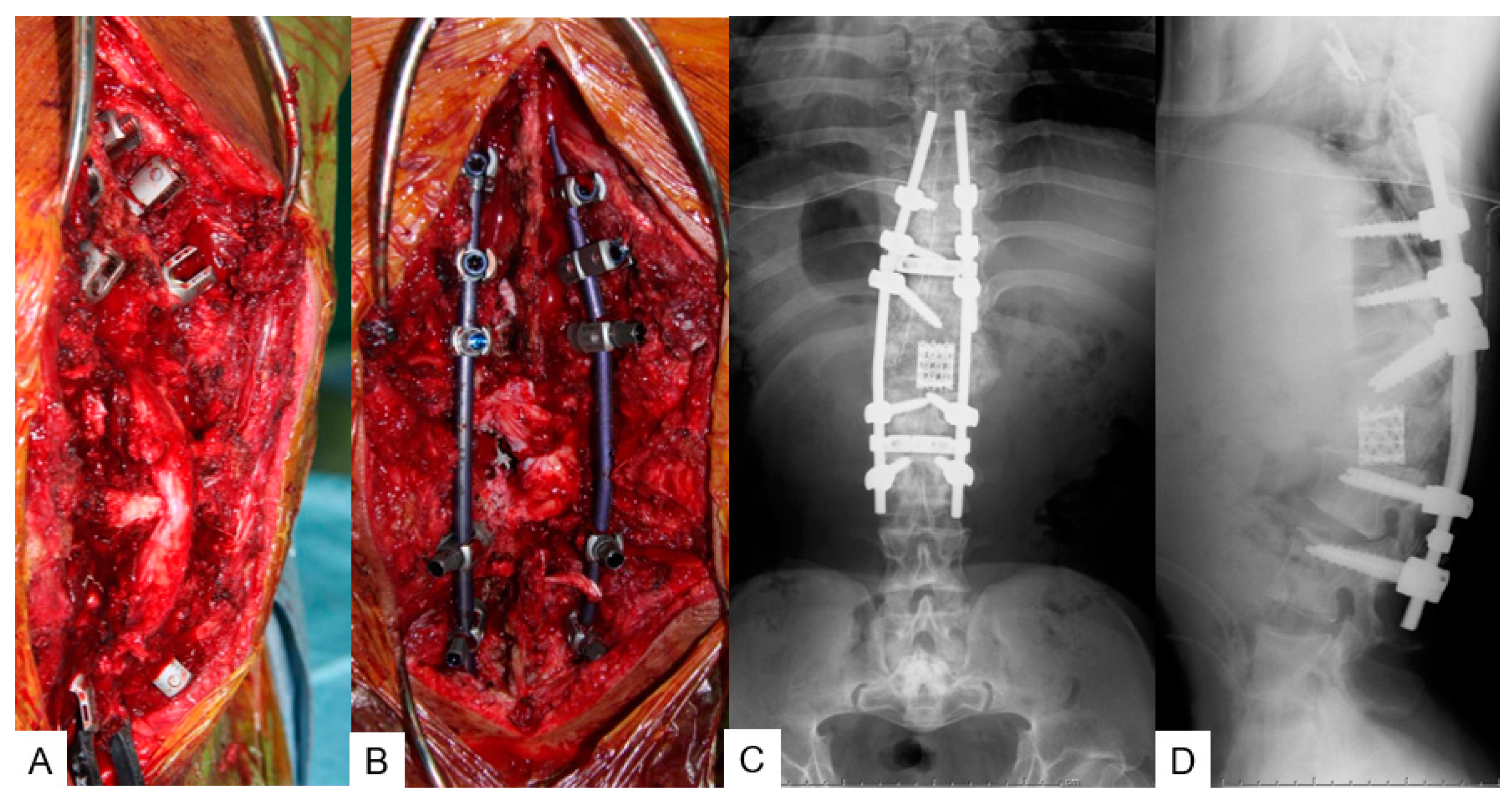 Medicina 58 00605 g007 550