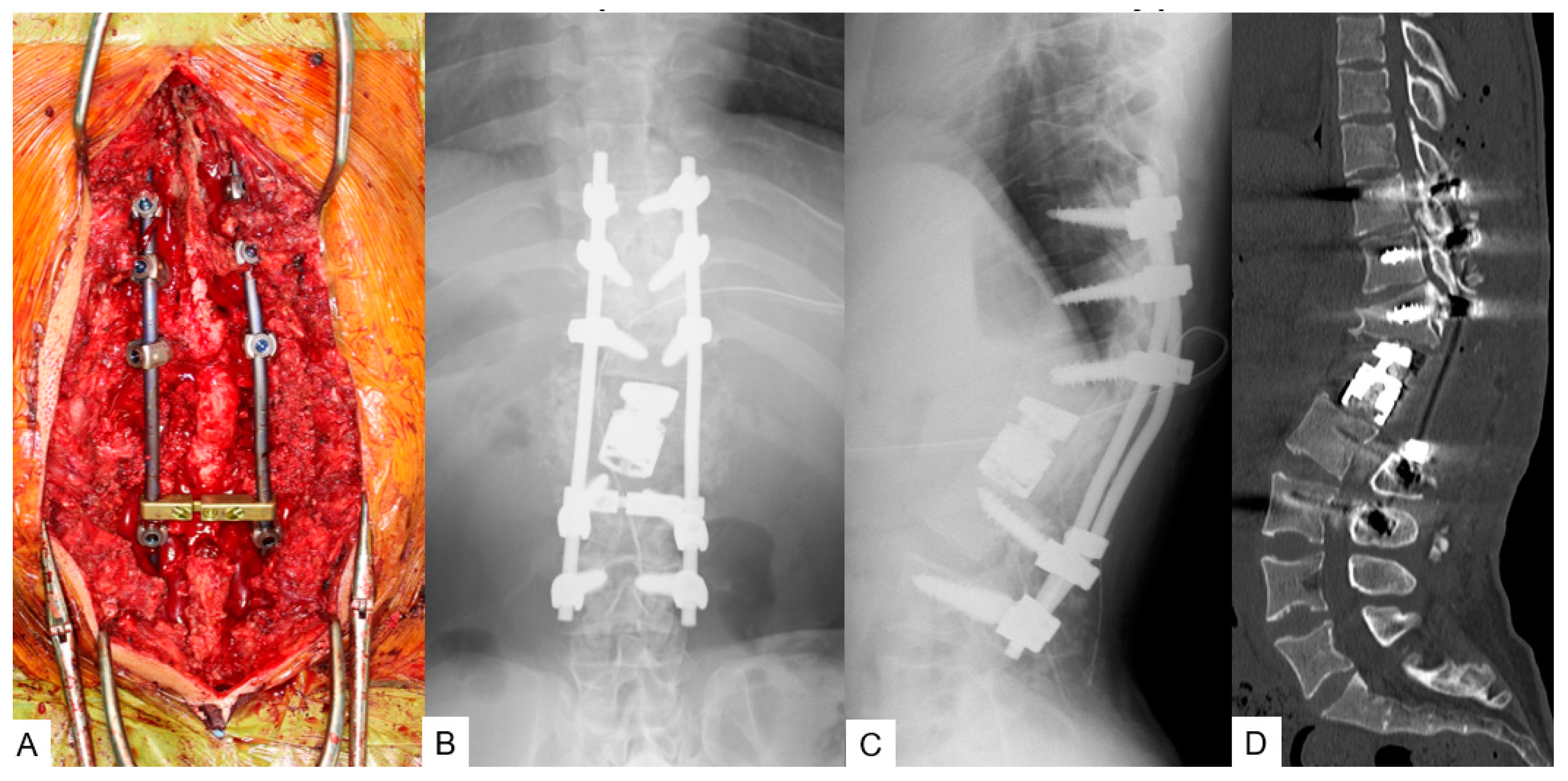 Medicina 58 00605 g011 550