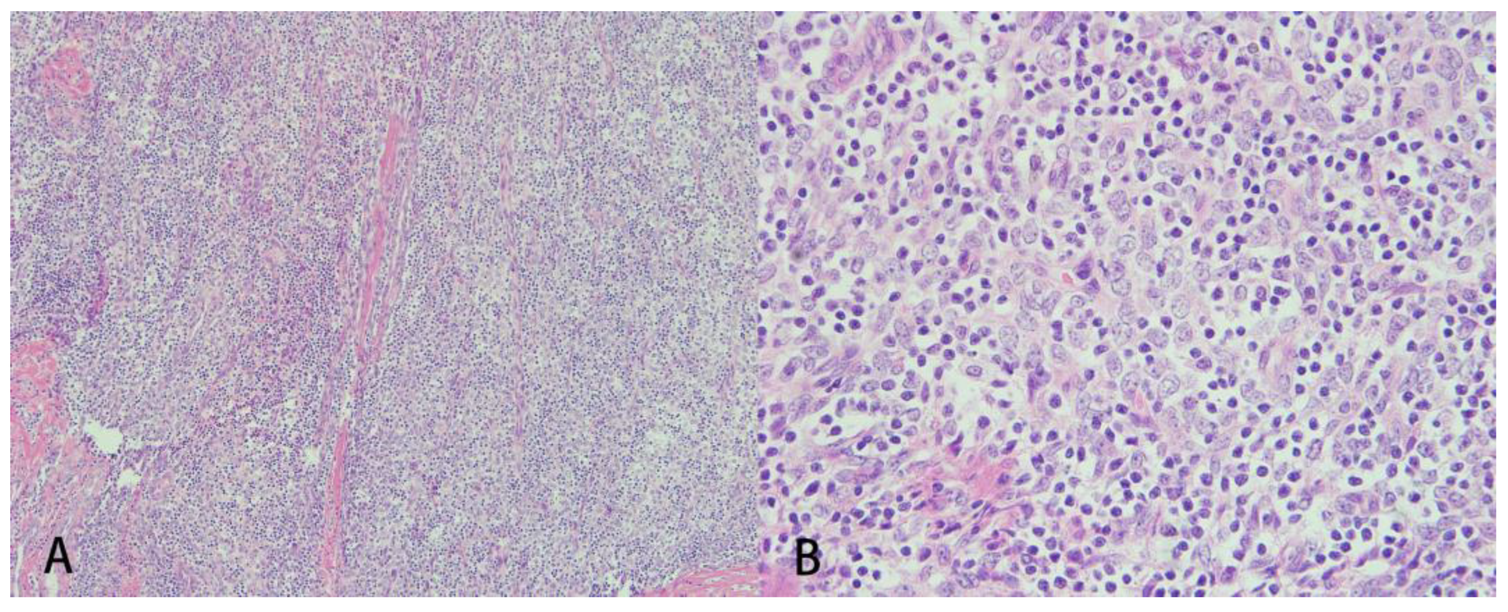 Medicina 58 00609 g003 550