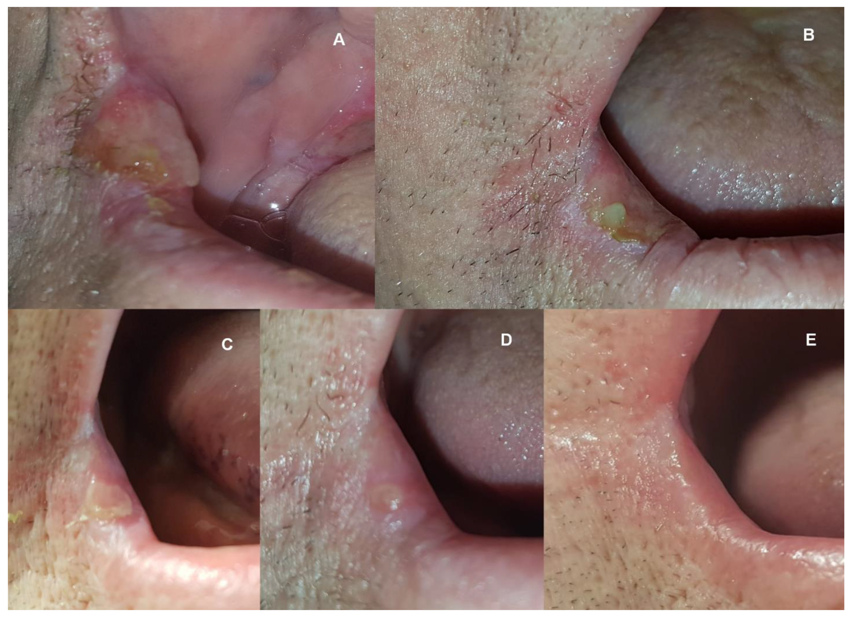 Medicina 58 00618 g003 550