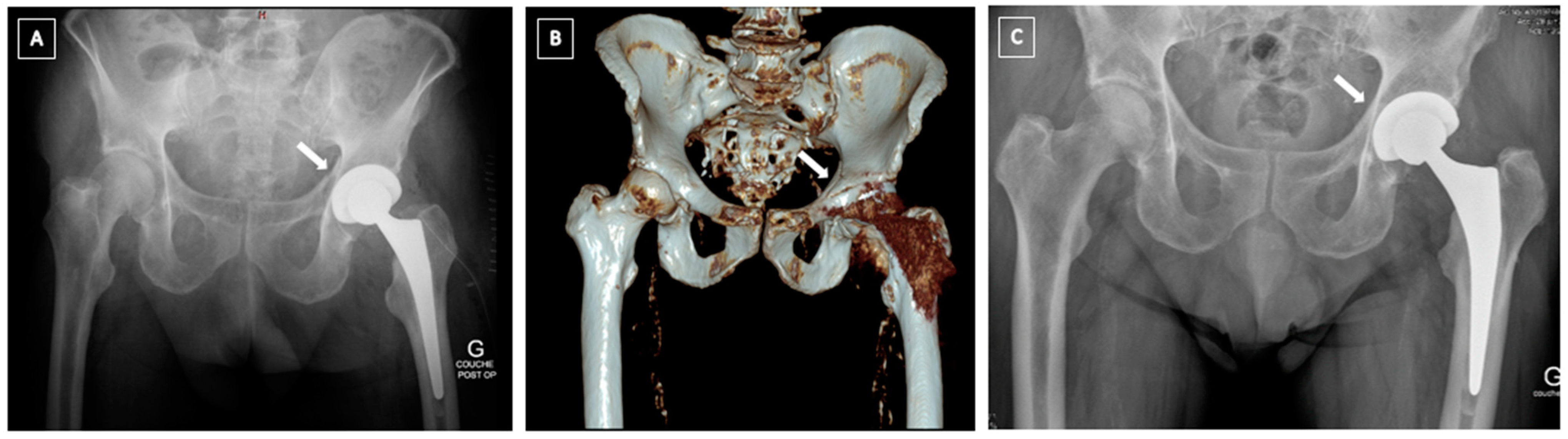 Medicina 58 00630 g002