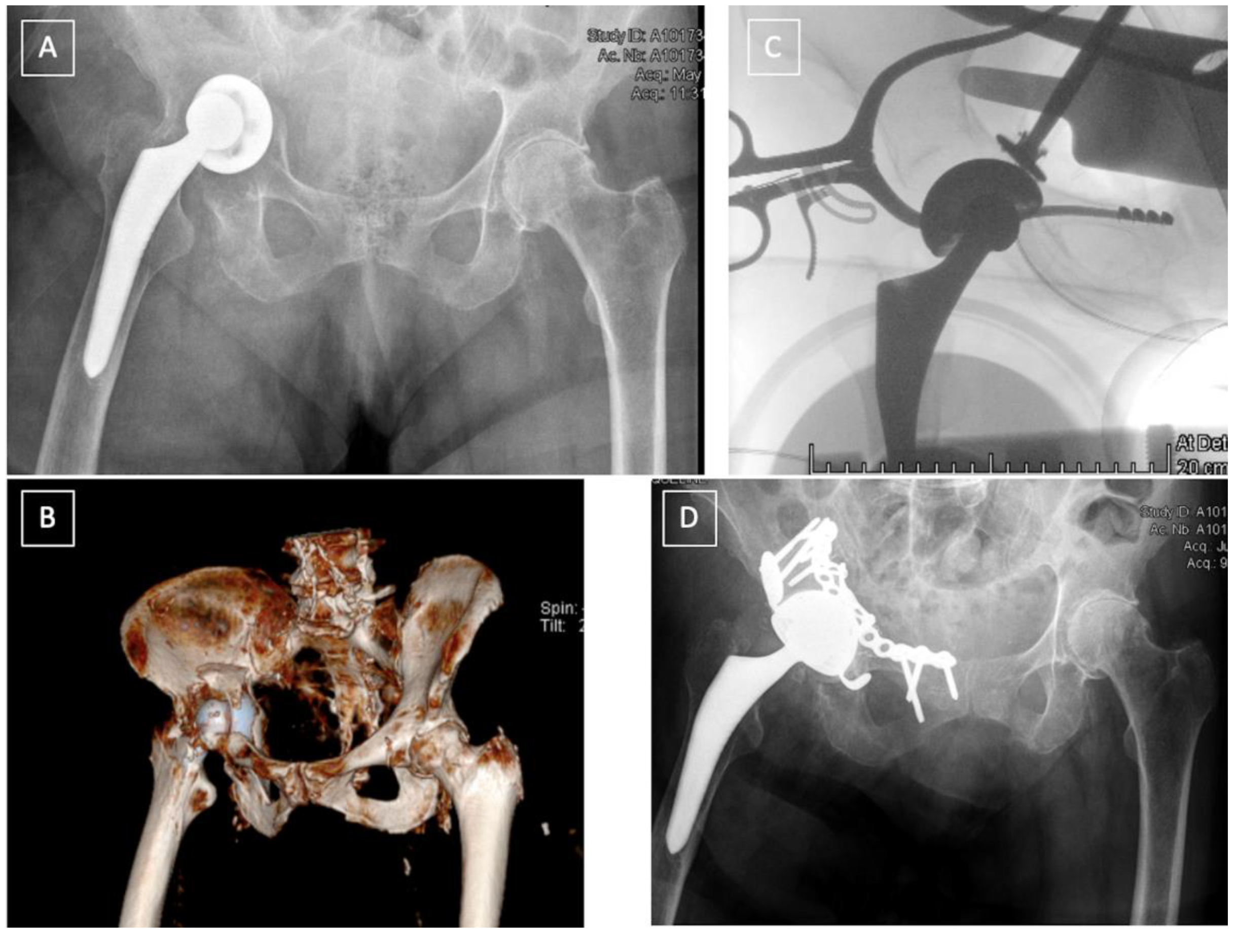 Medicina 58 00630 g004