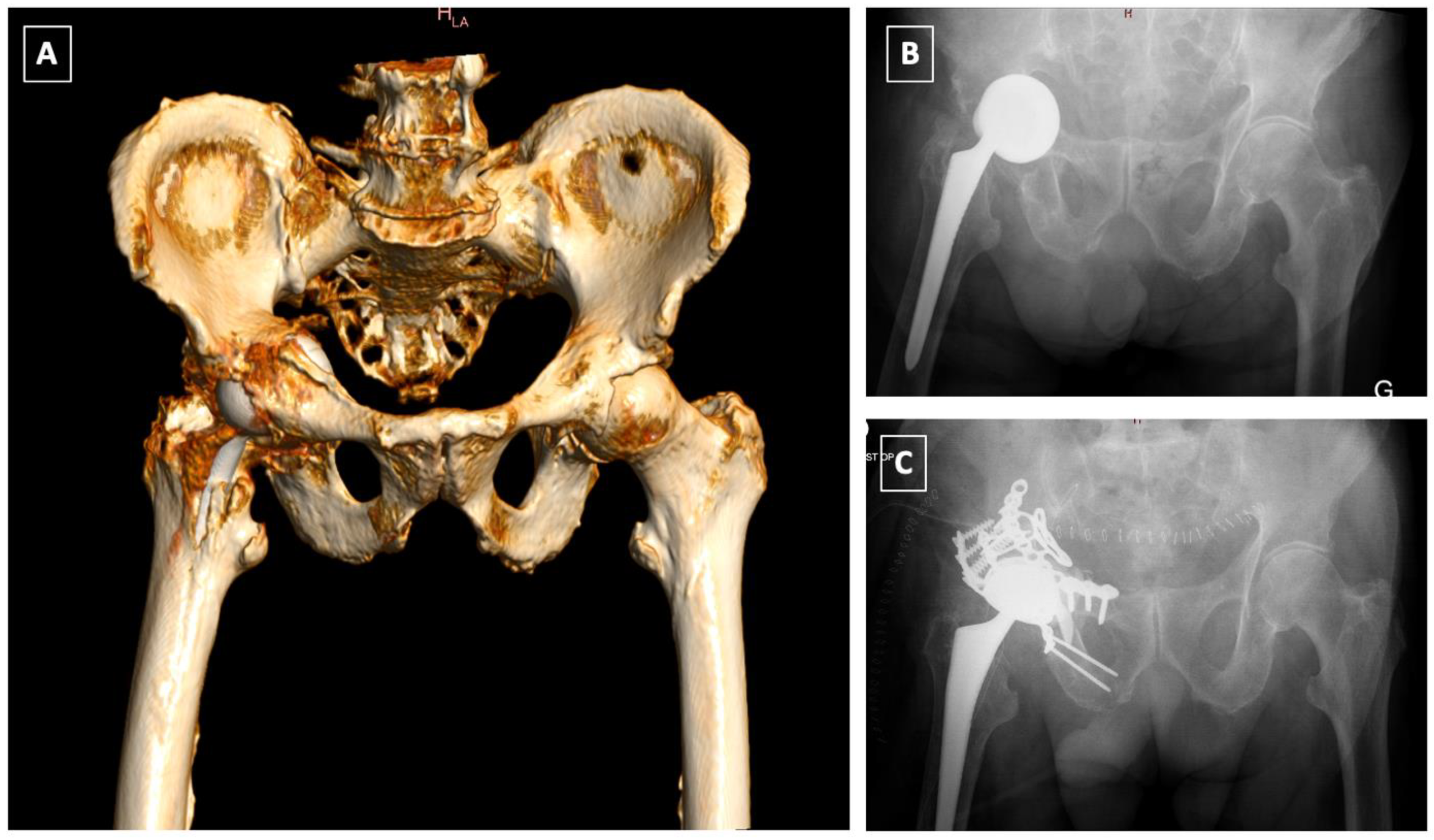 Medicina 58 00630 g005