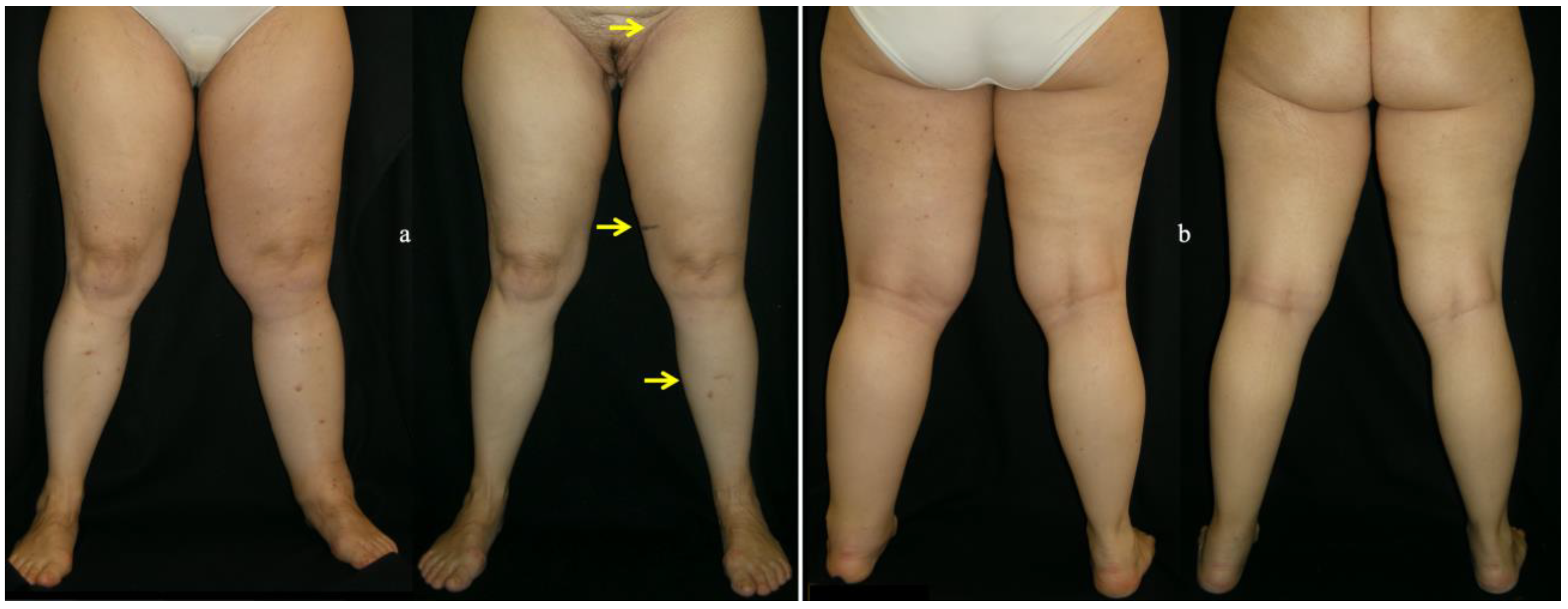 Medicina 58 00631 g003 550