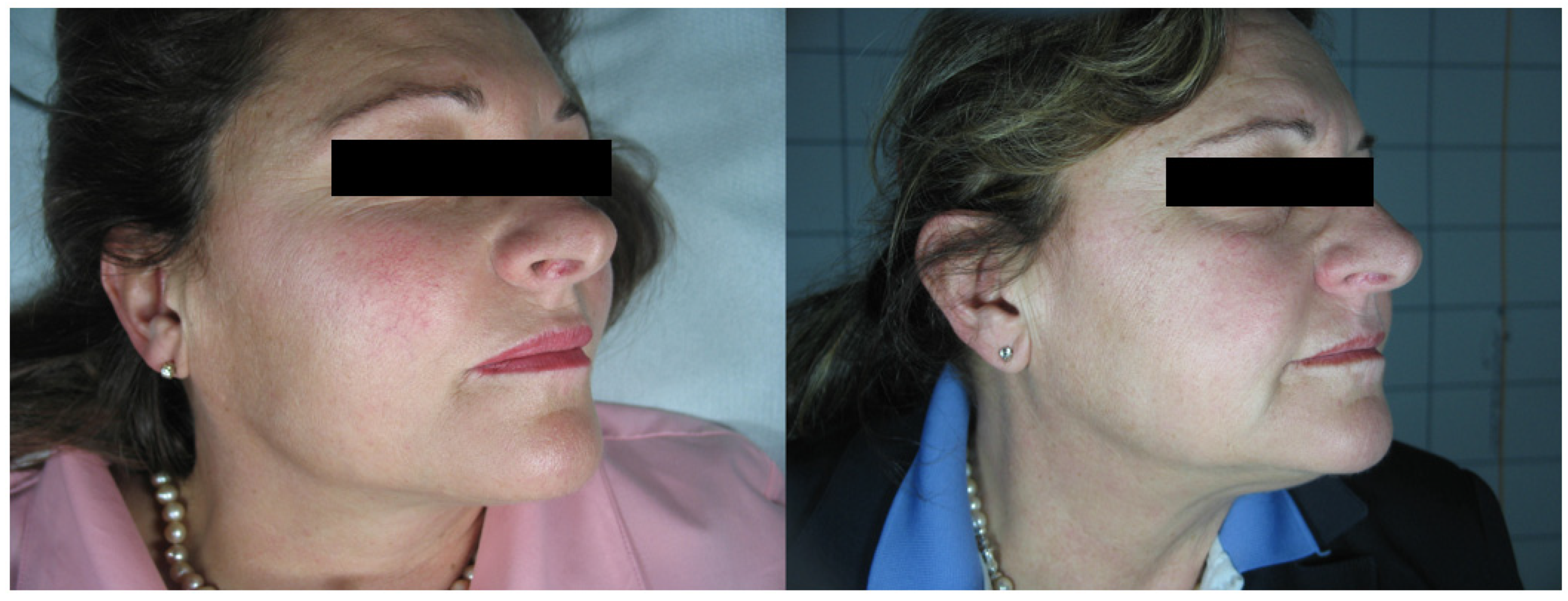 Medicina 58 00651 g004 550