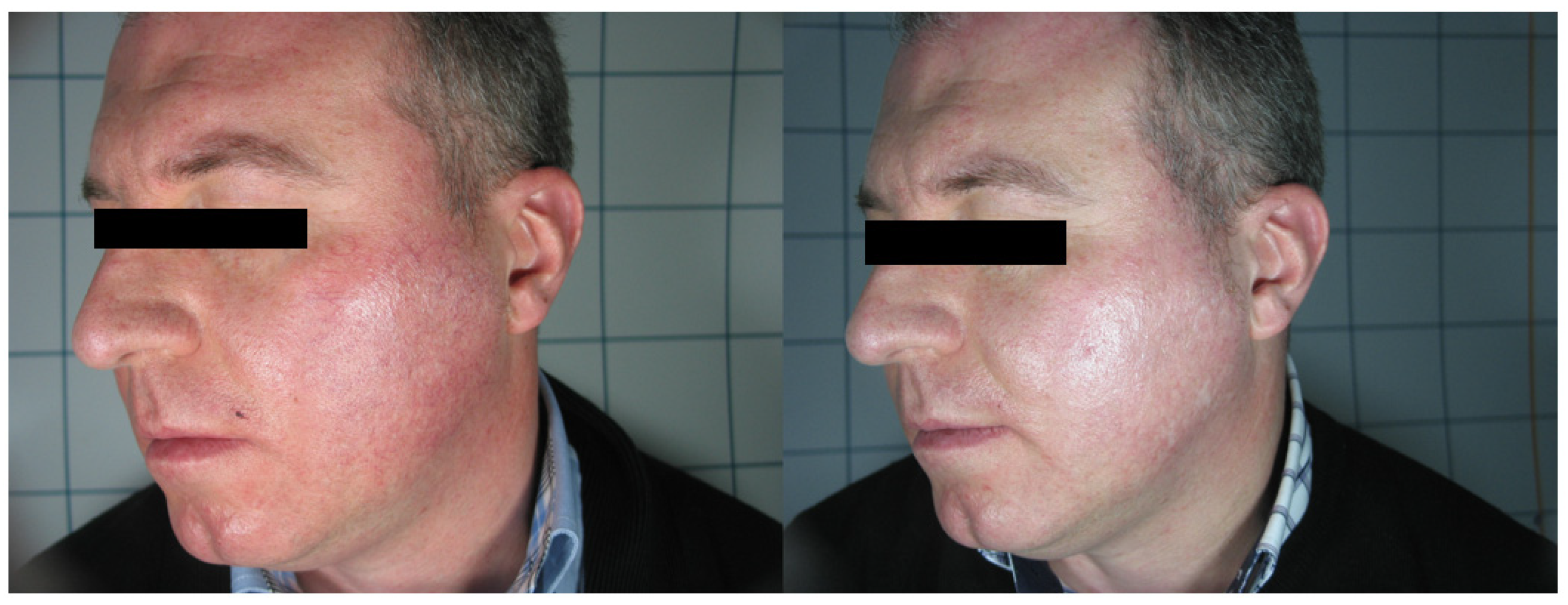 Medicina 58 00651 g005 550