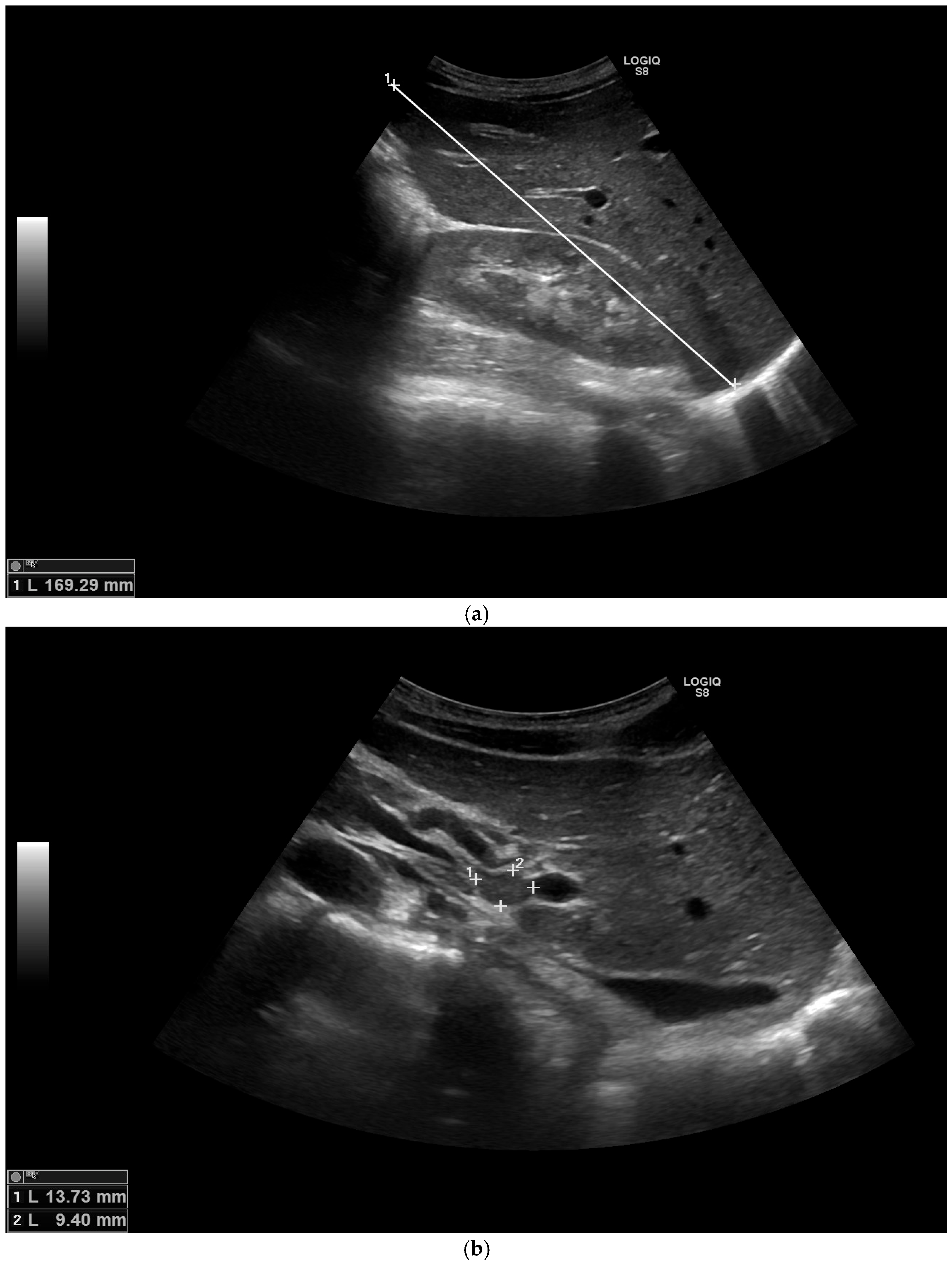 Medicina 58 00655 g001 550