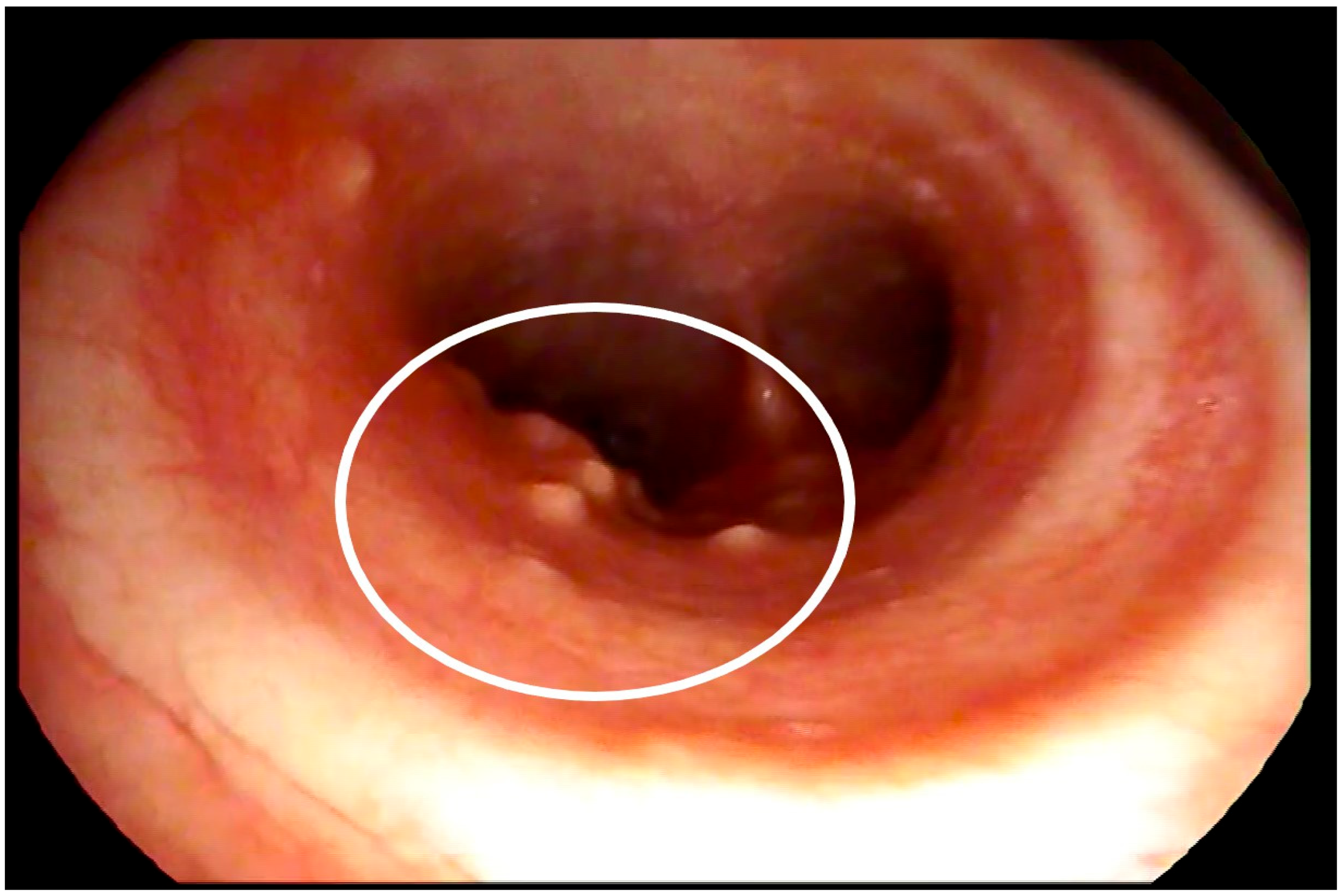 Medicina 58 00655 g003 550