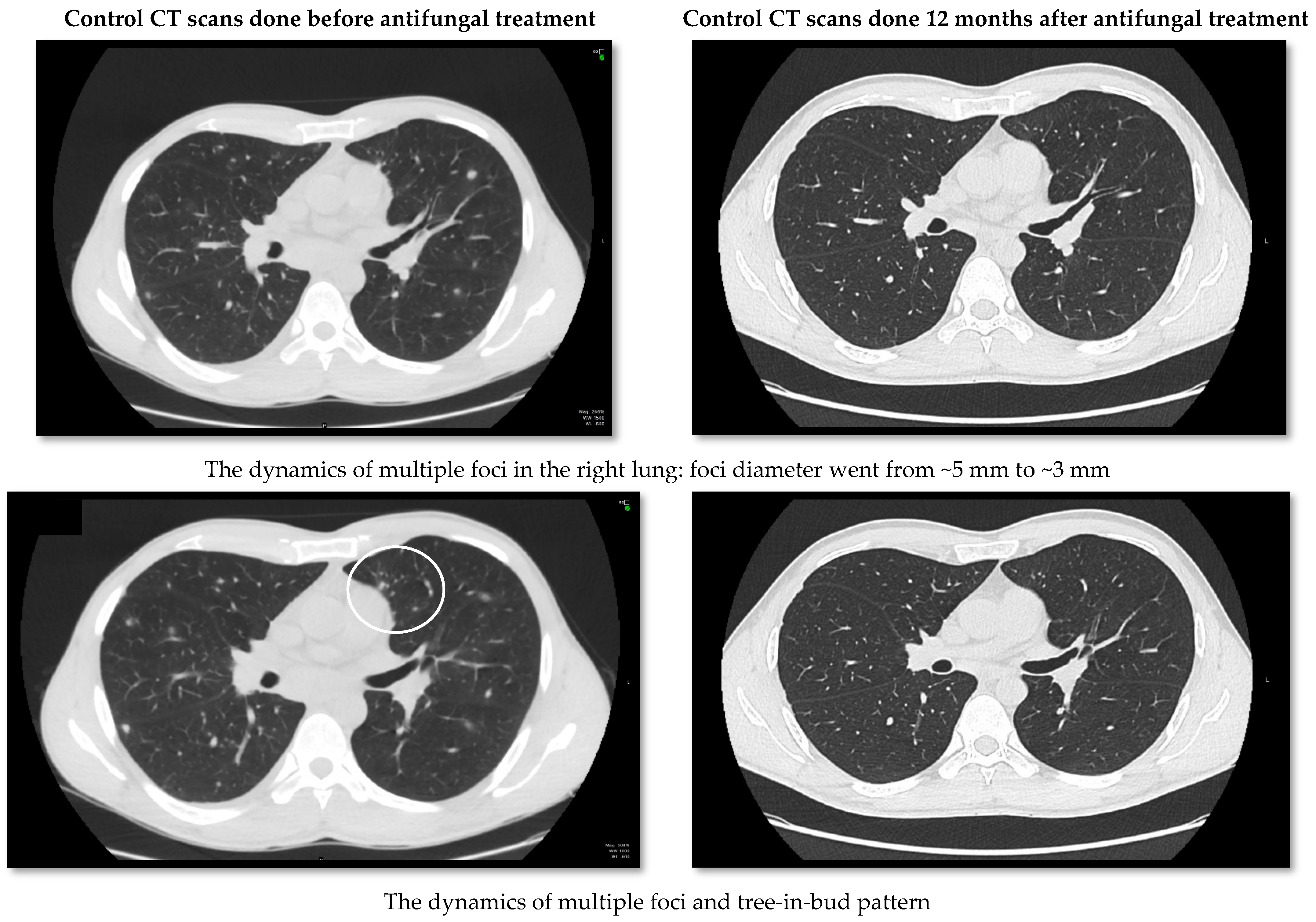 Medicina 58 00655 g004a 550