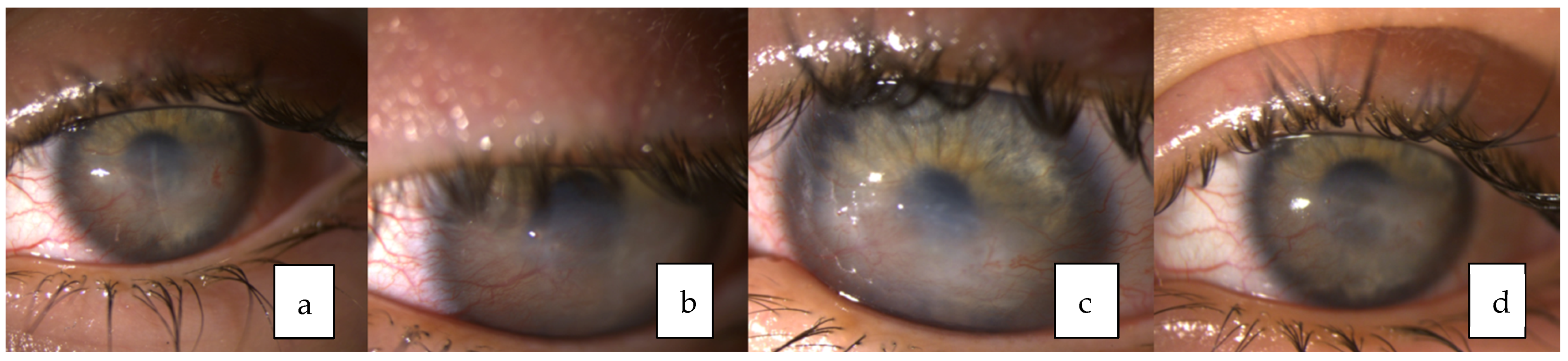 Medicina 58 00657 g004