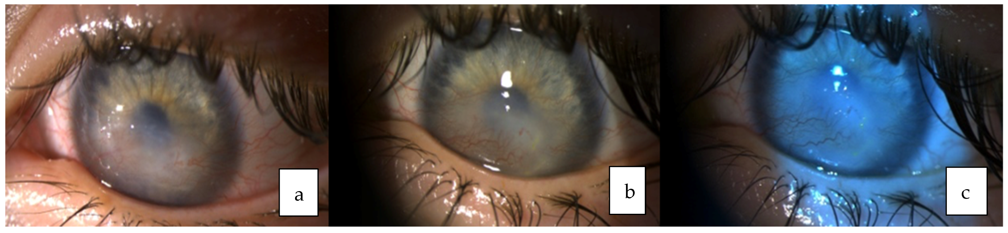 Medicina 58 00657 g005