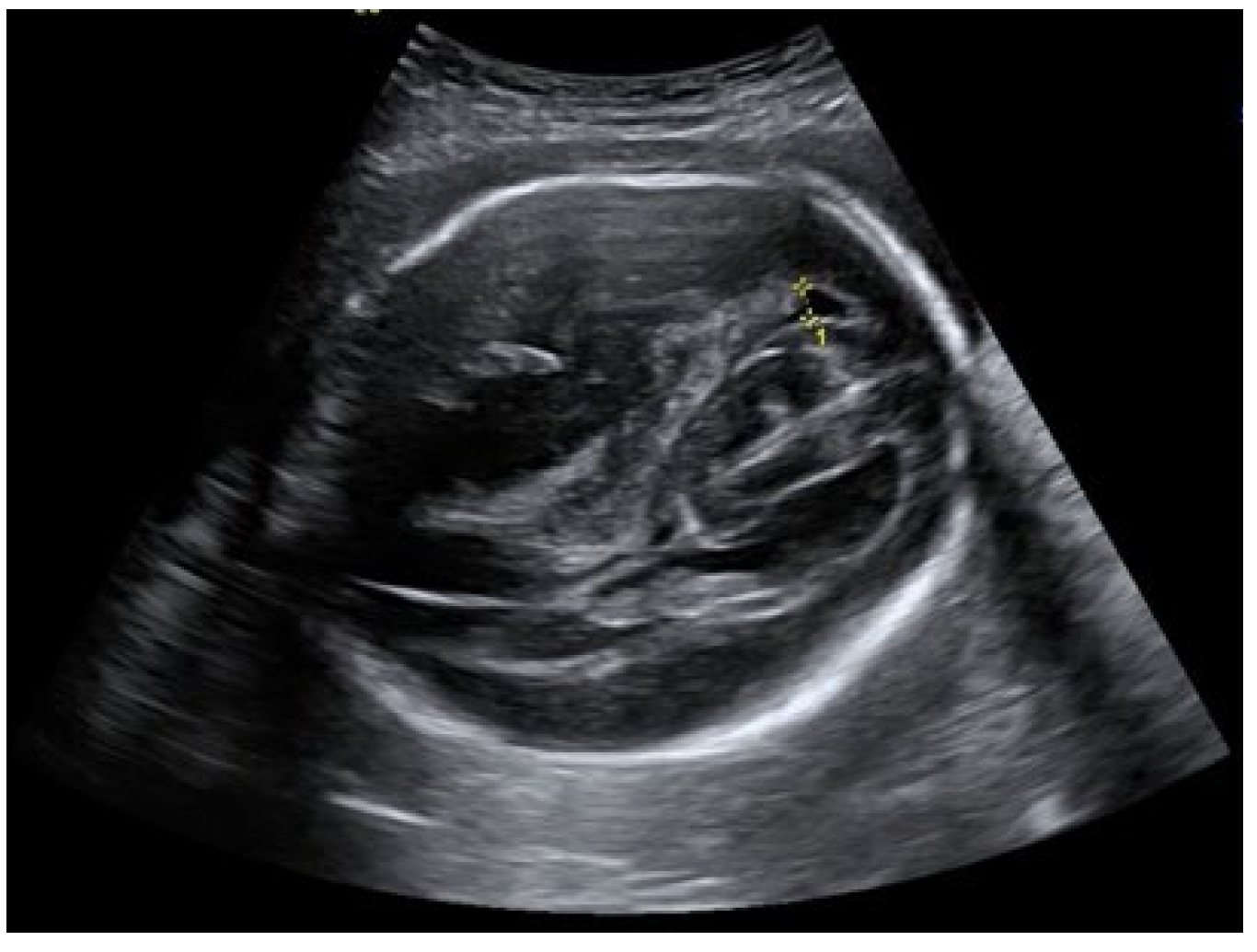 Medicina 58 00664 g002 550