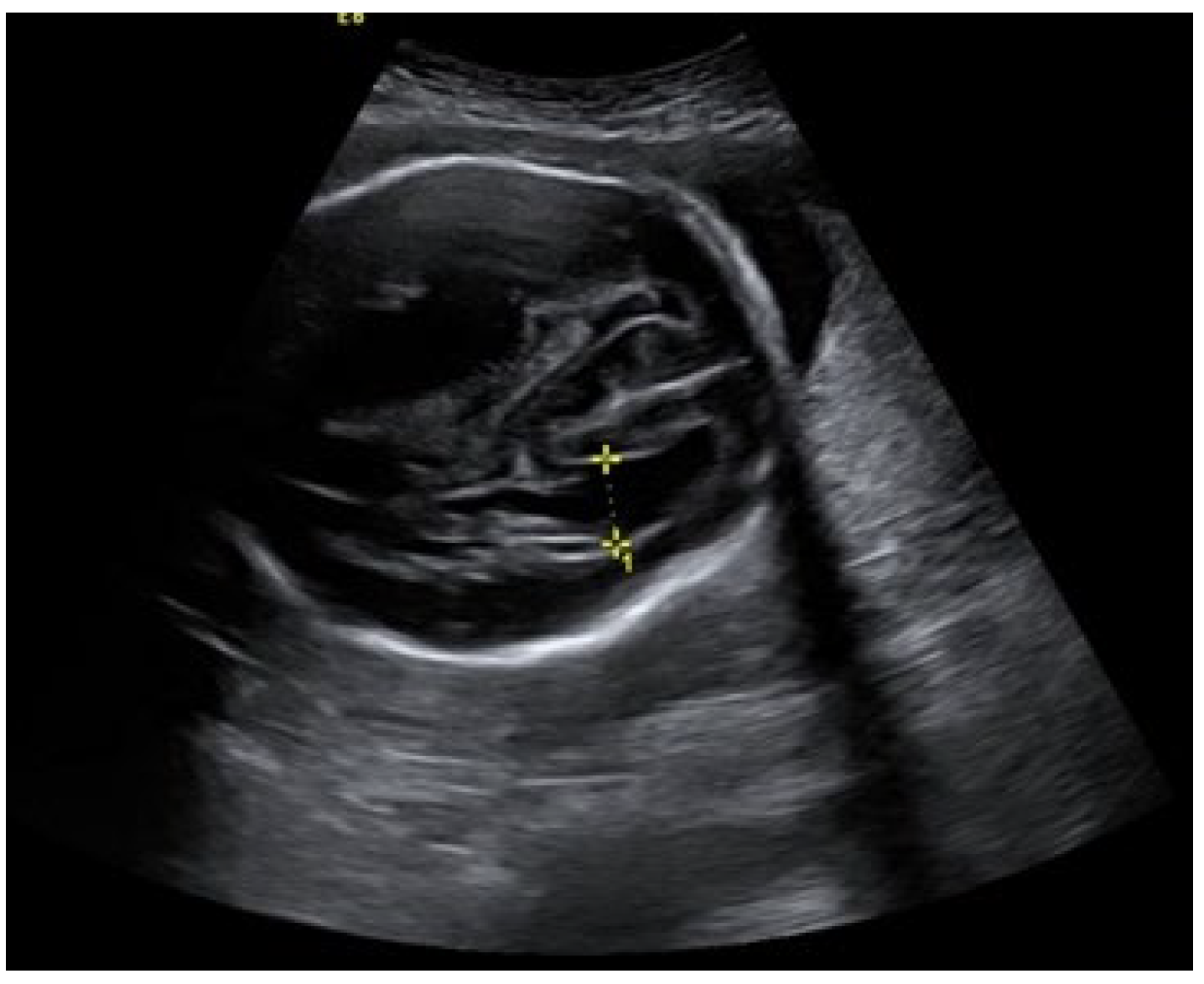 Medicina 58 00664 g003 550