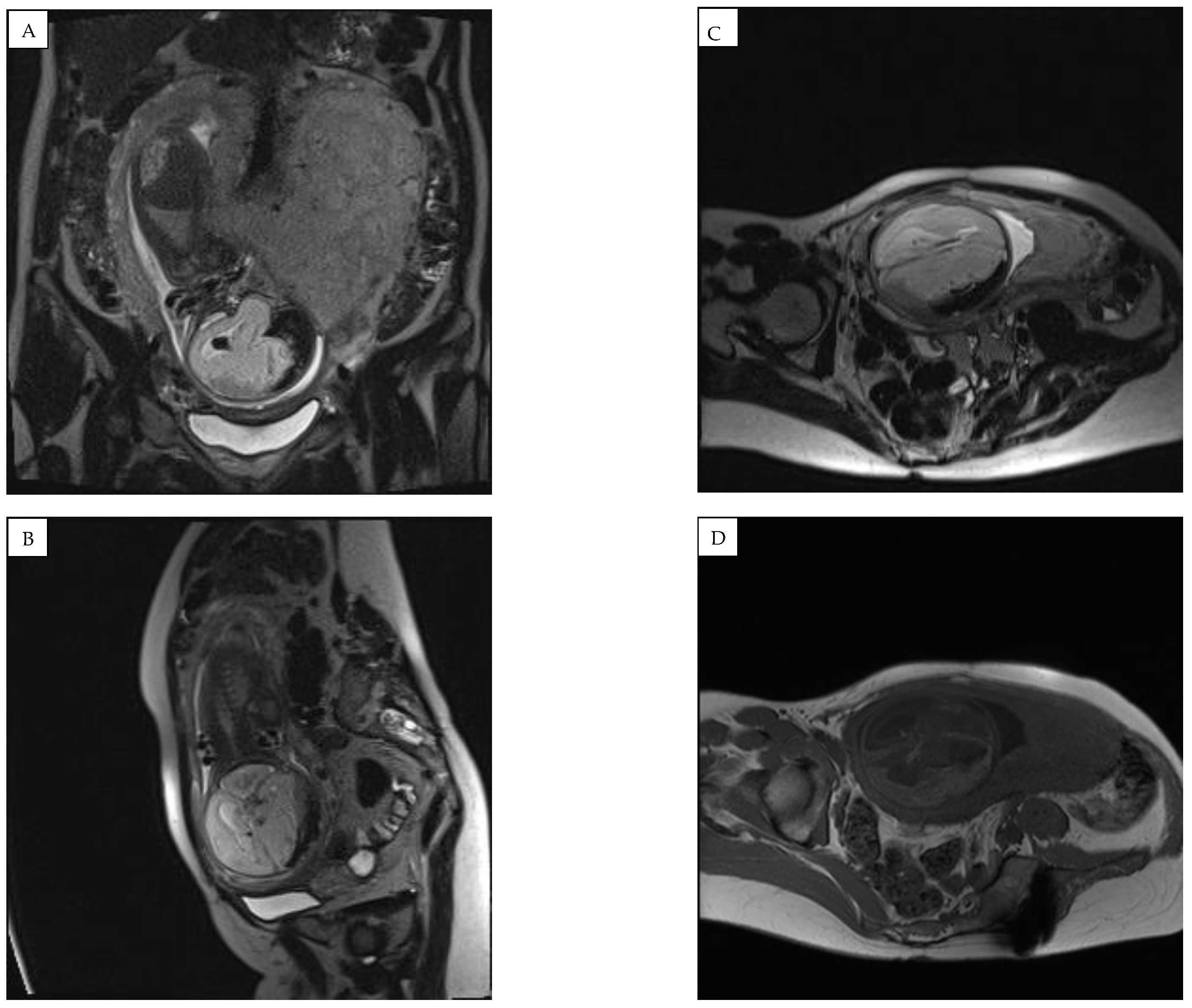 Medicina 58 00664 g004 550