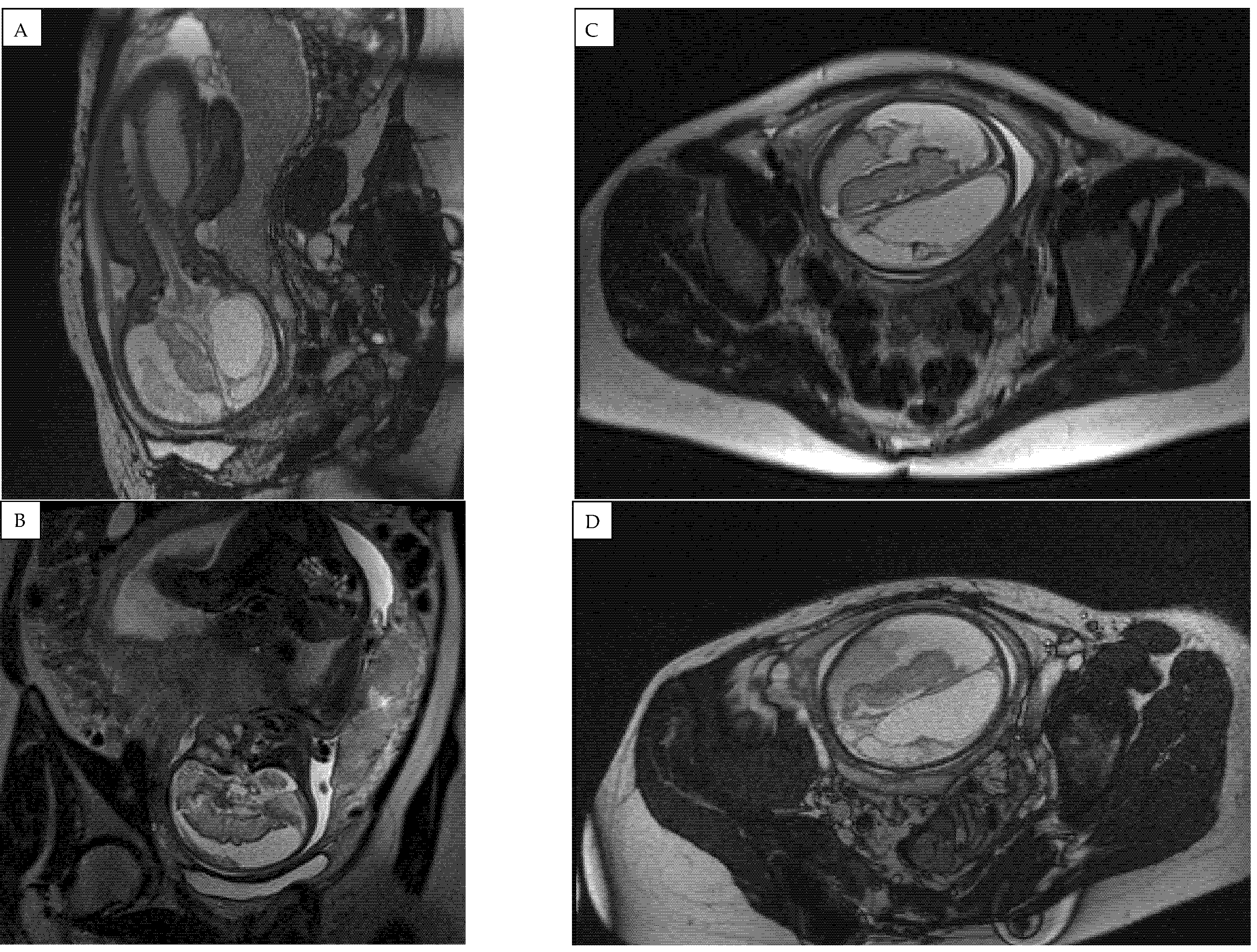 Medicina 58 00664 g005 550