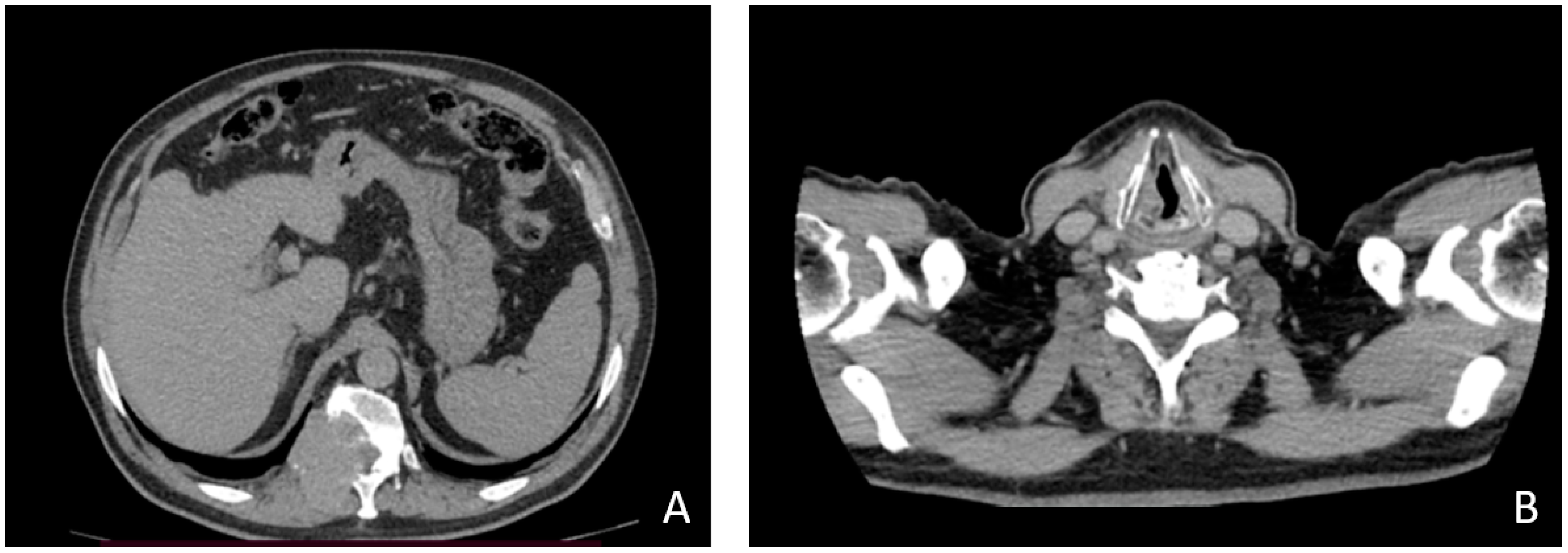 Medicina 58 00666 g002 550