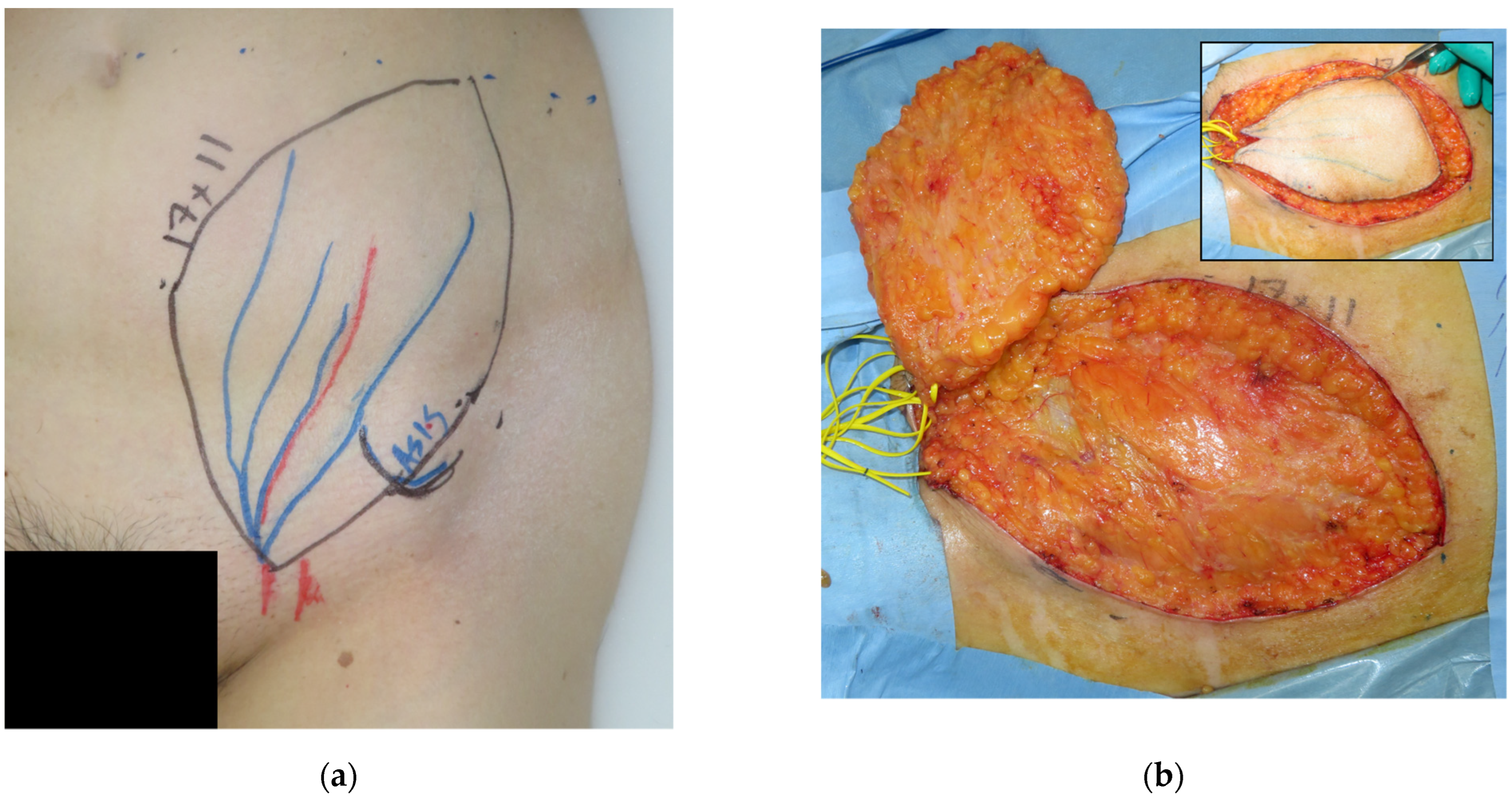 Medicina 58 00670 g006a 550