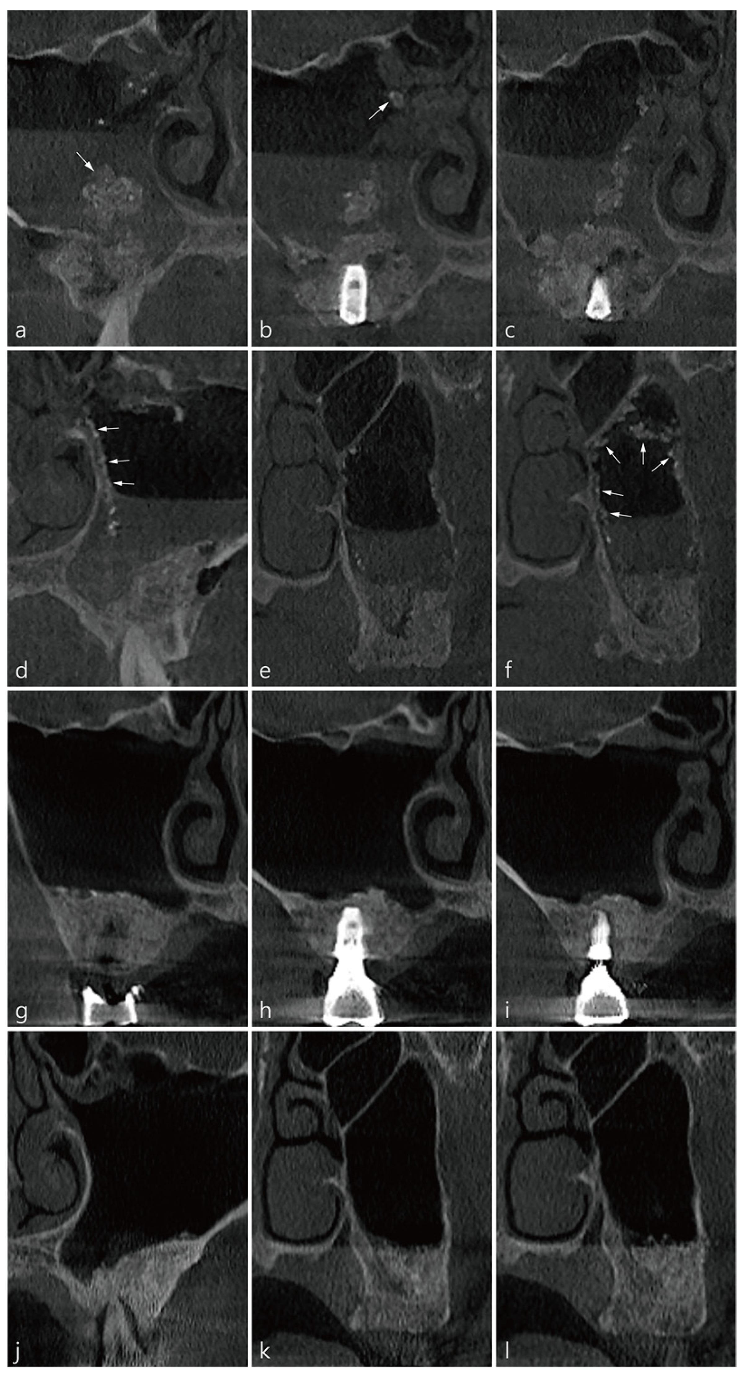 Medicina 58 00672 g002 550