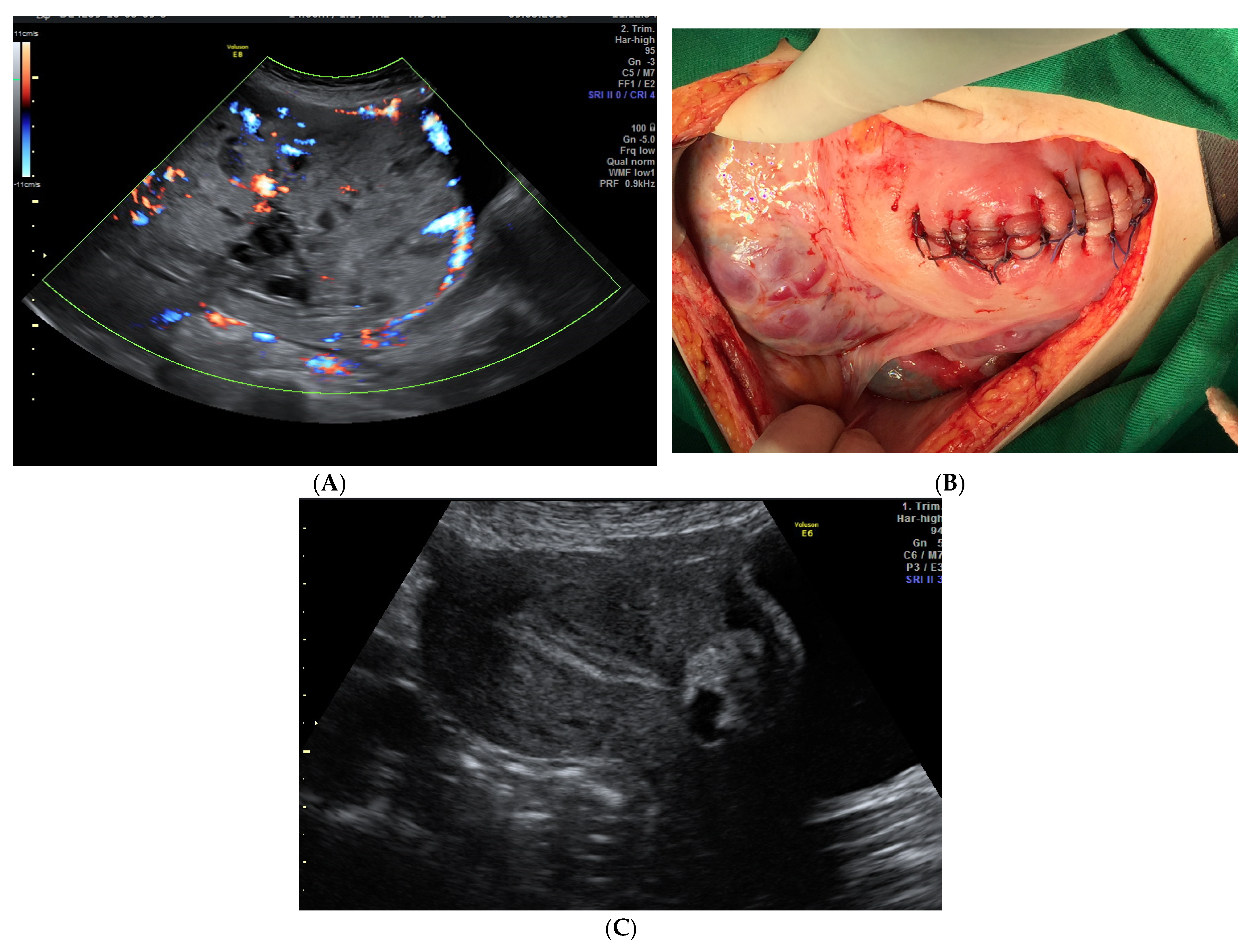 Medicina 58 00678 g001