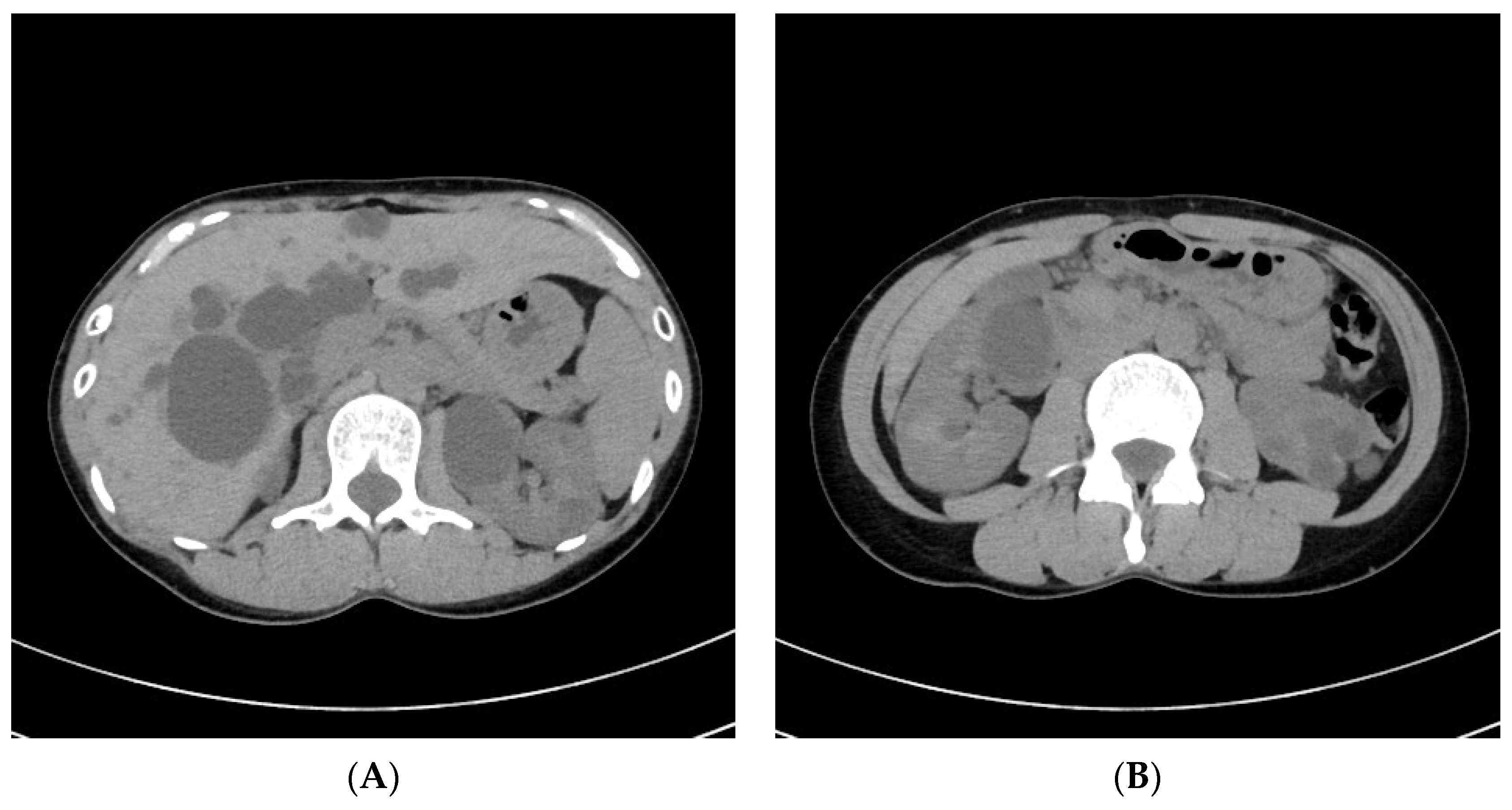 Medicina 58 00679 g001 Medicina 58 00679 g001