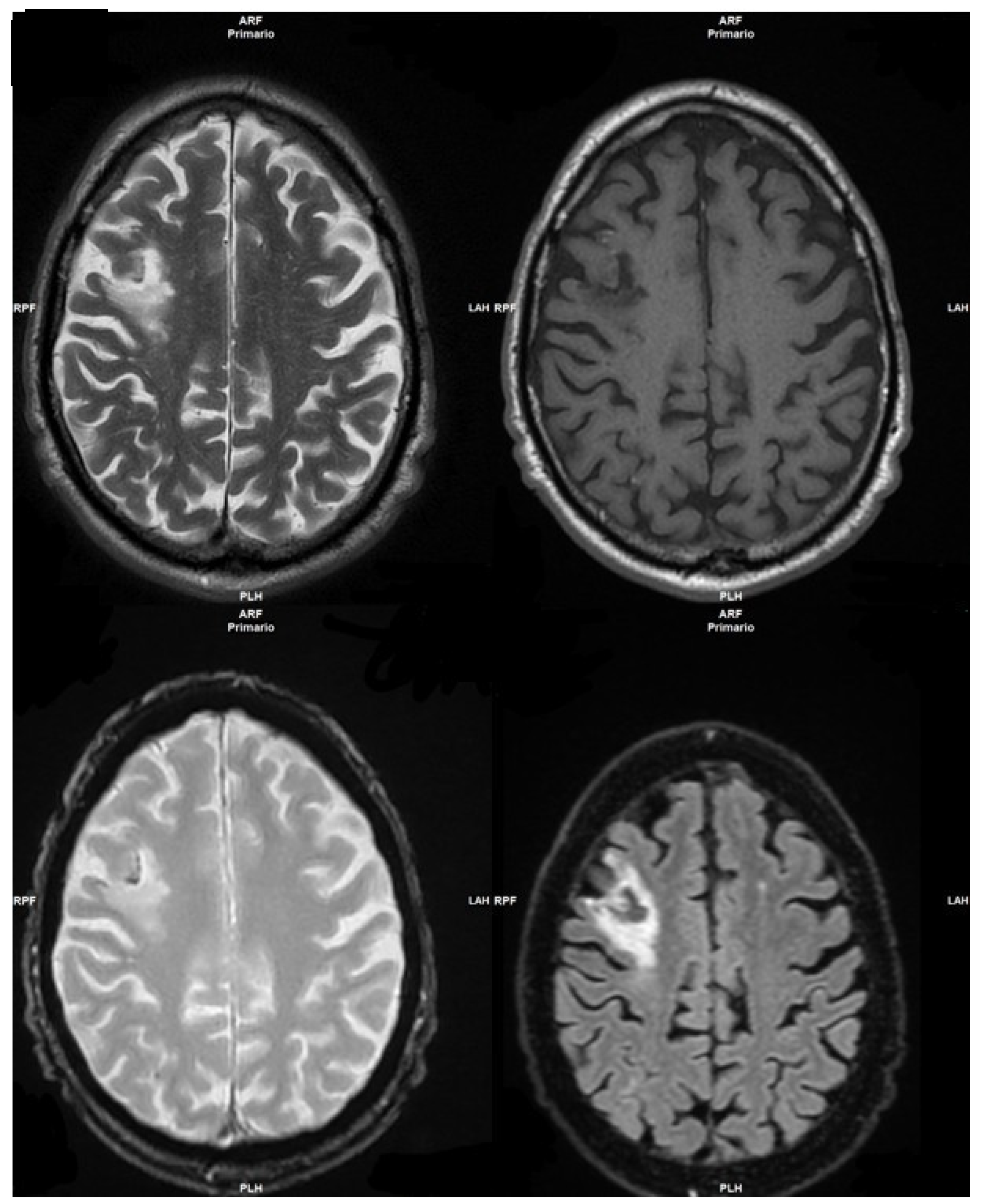 Medicina 58 00697 g001 550