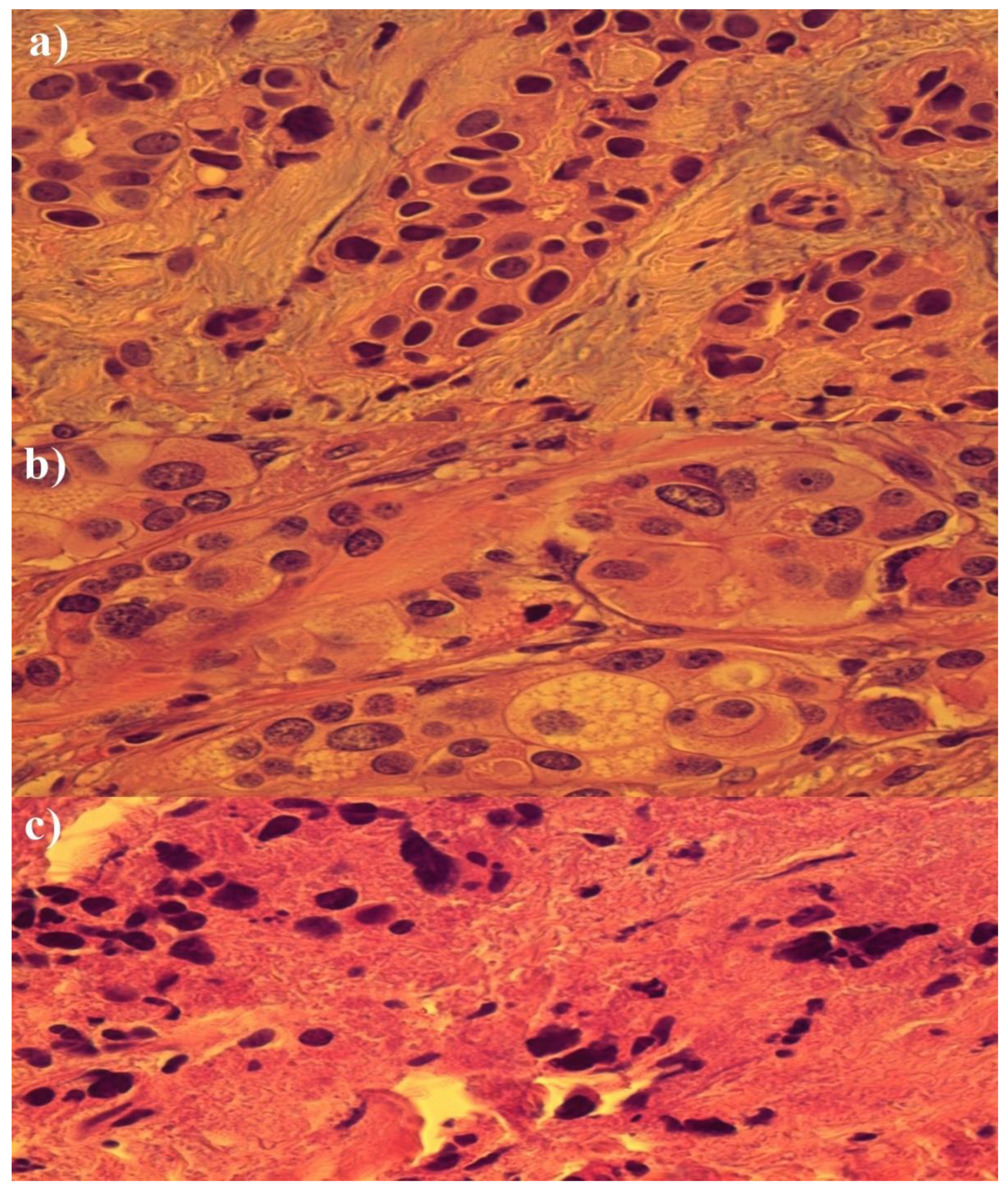 Medicina 58 00700 g003