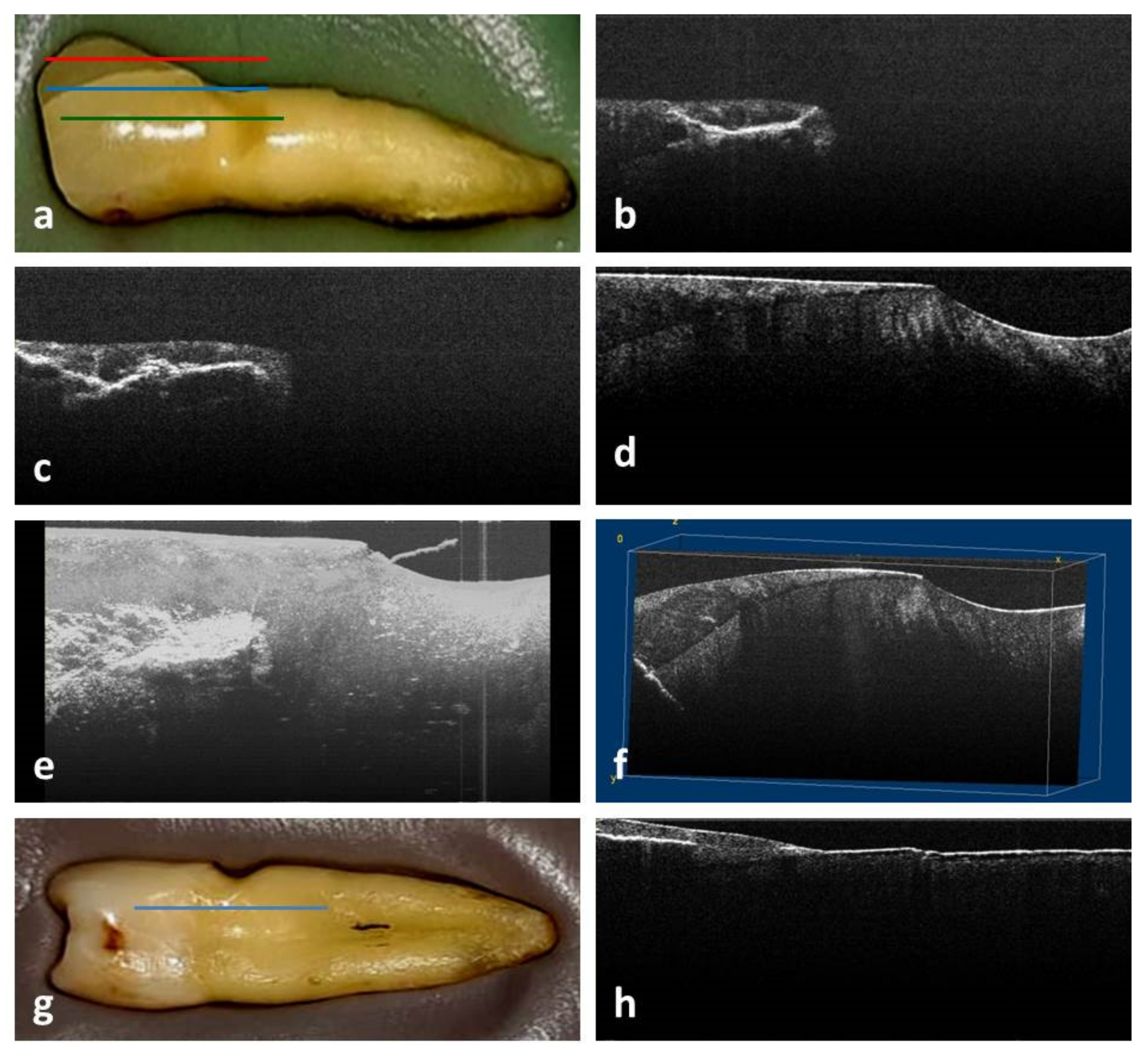 Medicina 58 00702 g001 550