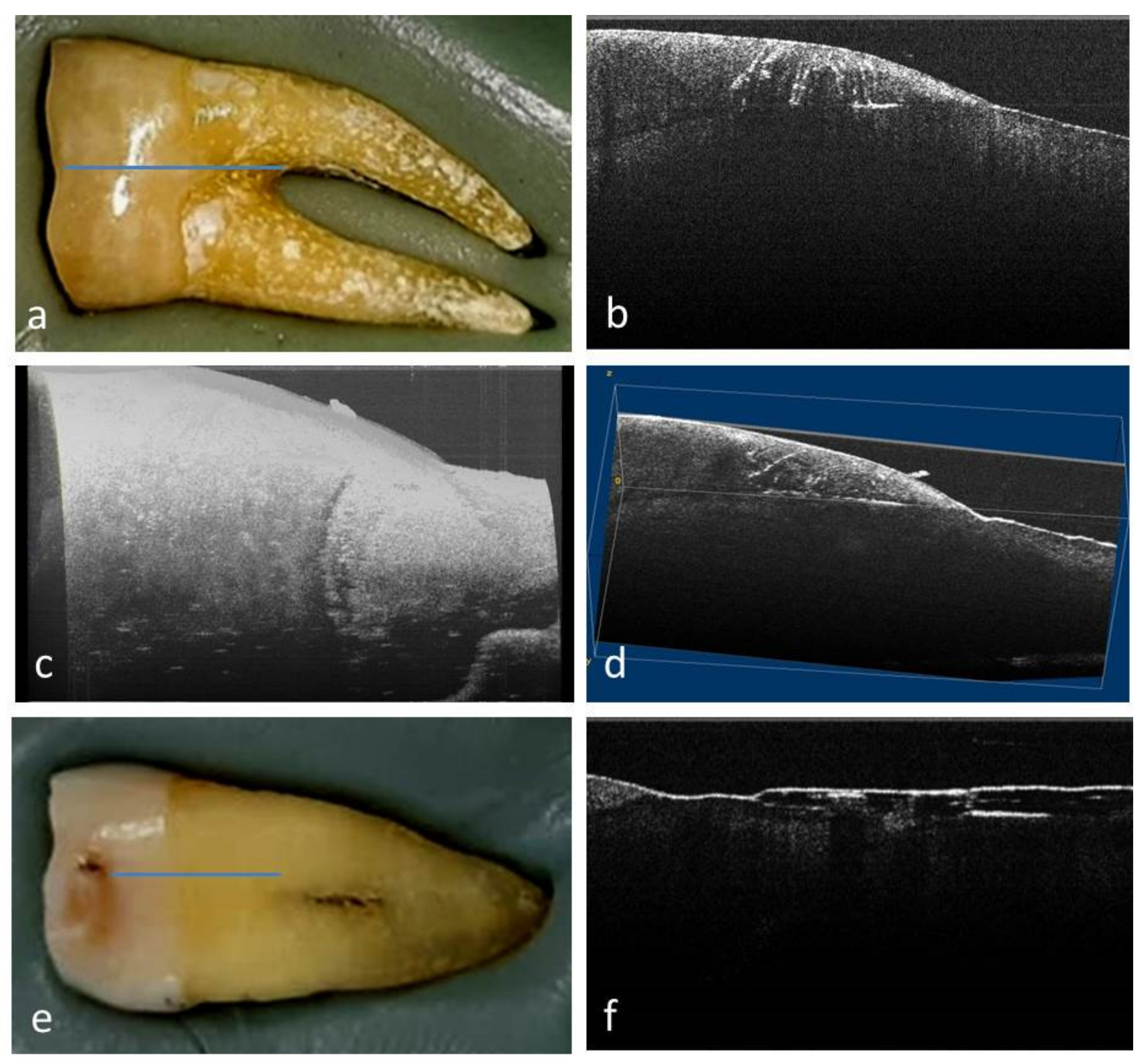 Medicina 58 00702 g003 550