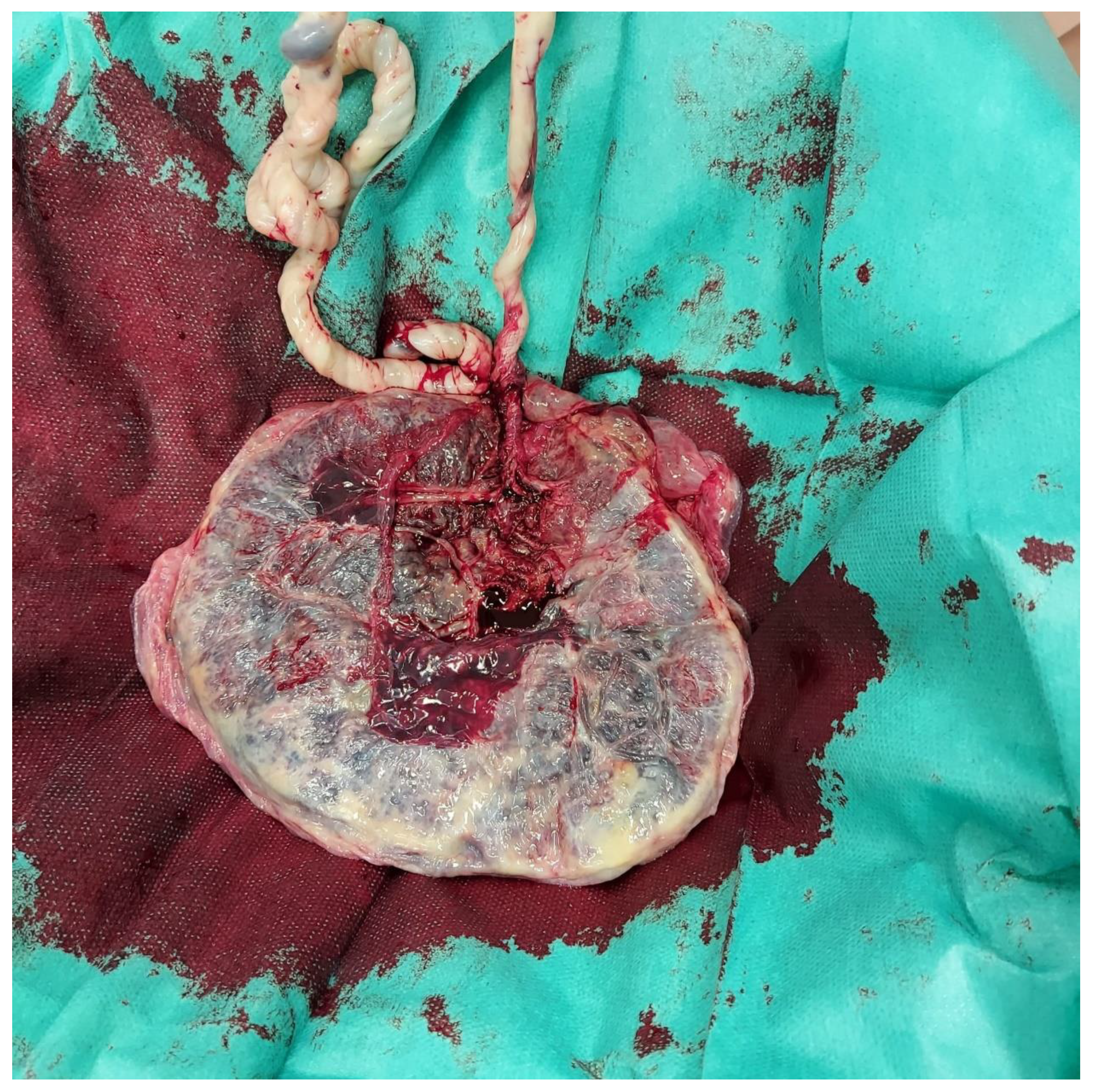 Medicina 58 00703 g002 550