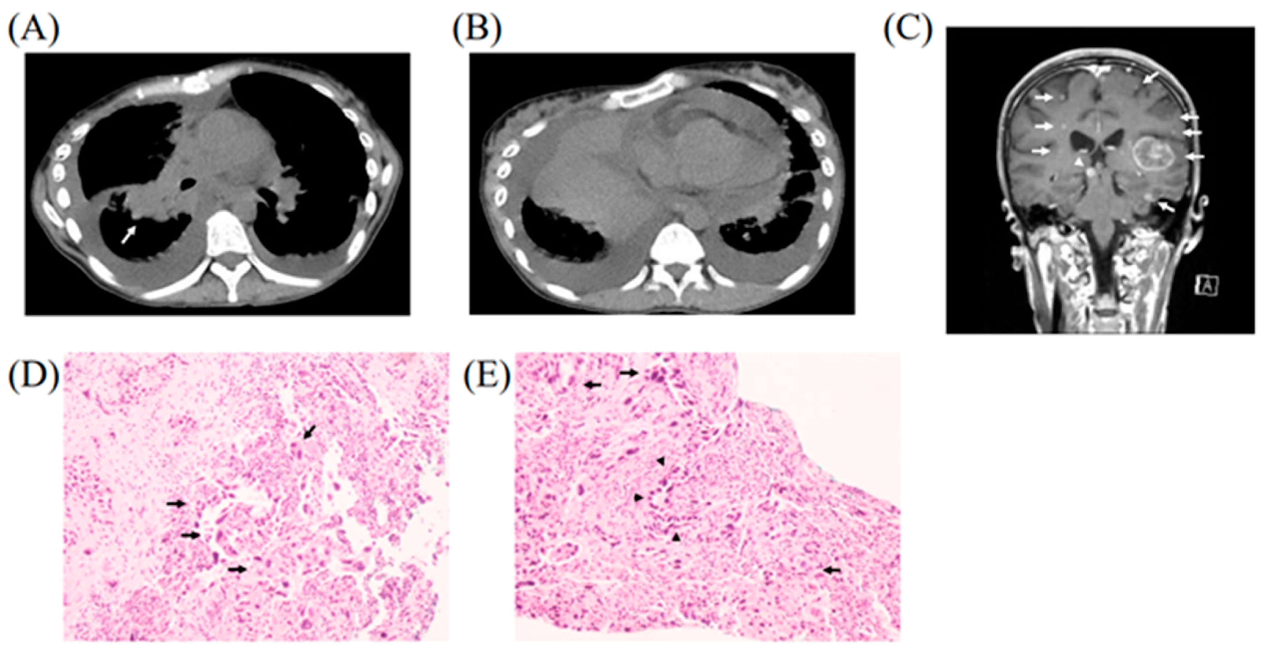 Medicina 58 00706 g001 550