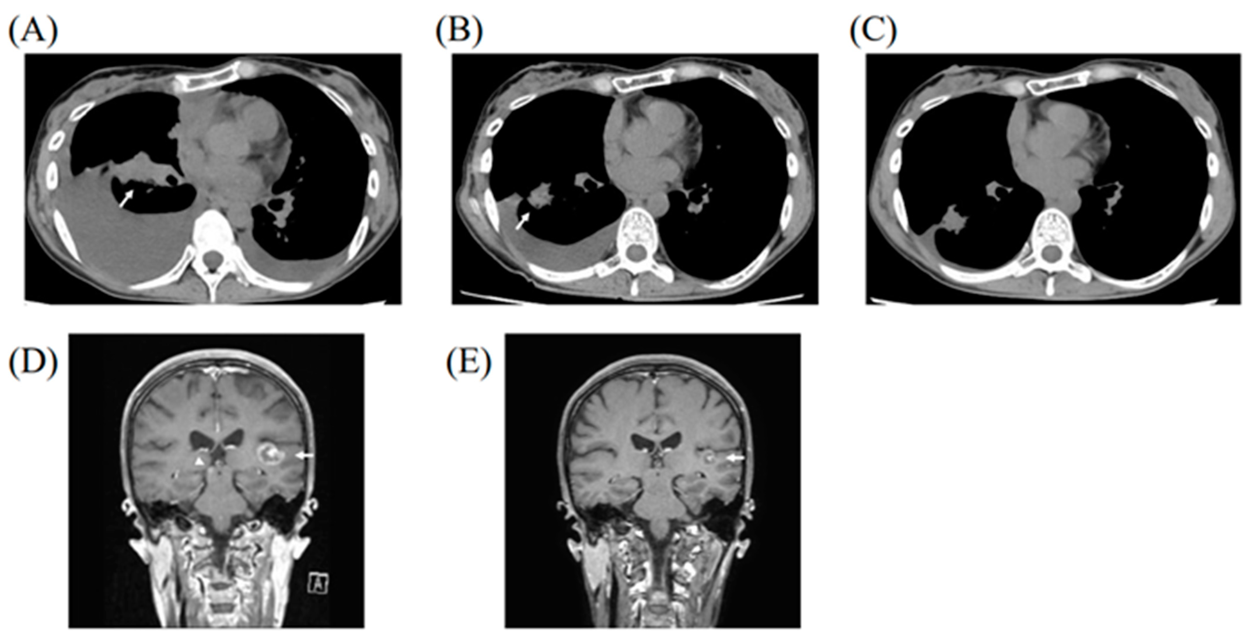 Medicina 58 00706 g002 550