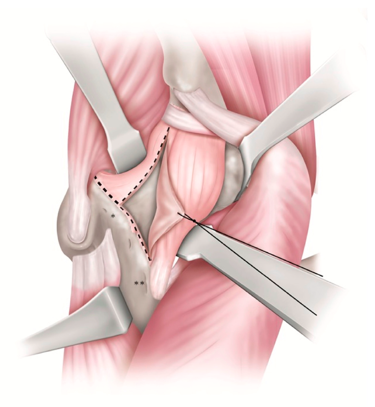 Medicina 58 00713 g001