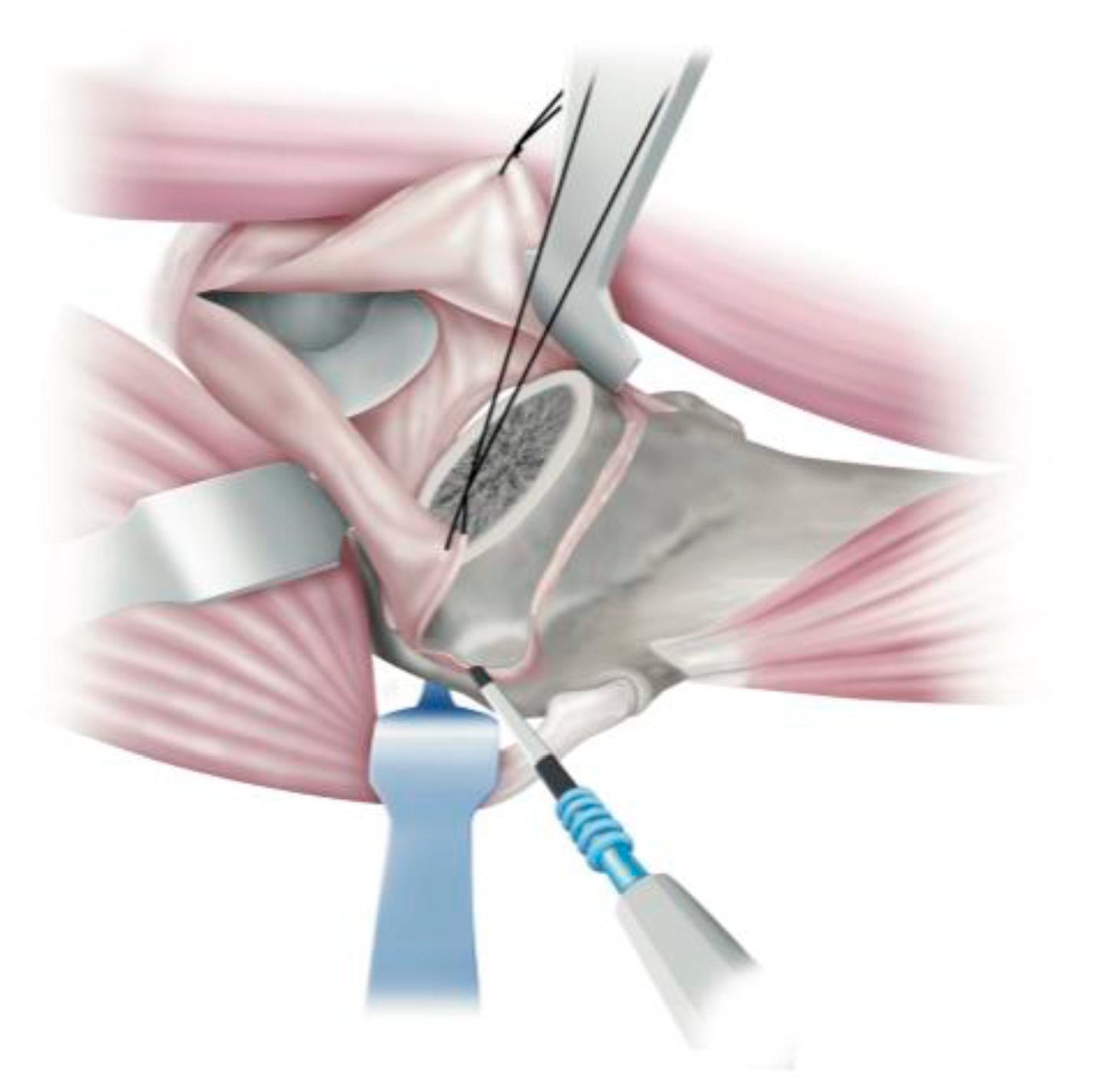 Medicina 58 00713 g002