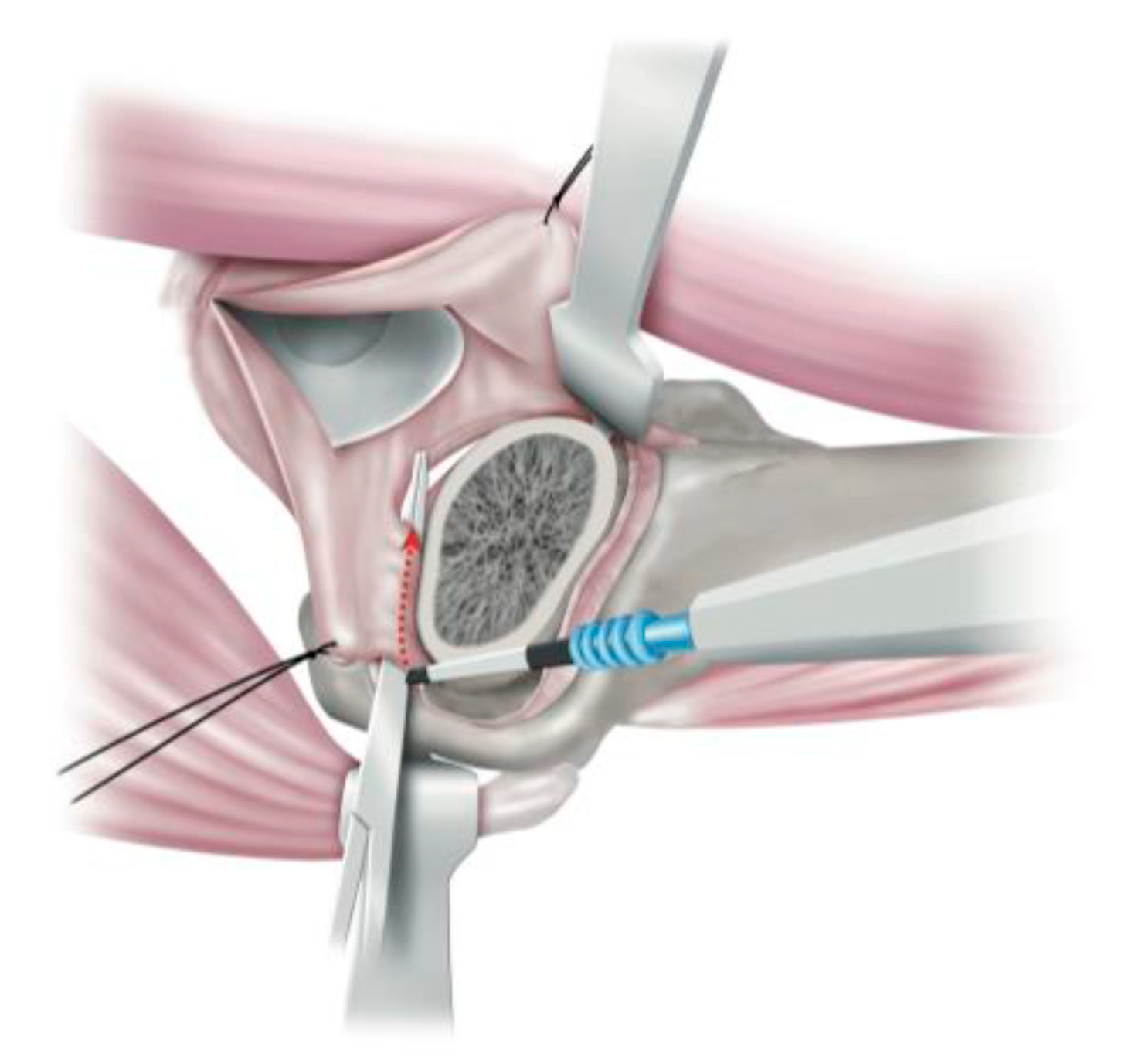 Medicina 58 00713 g003