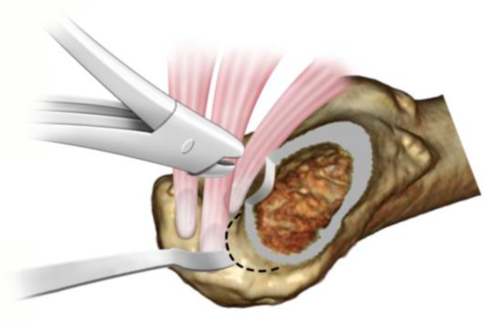 Medicina 58 00713 g005