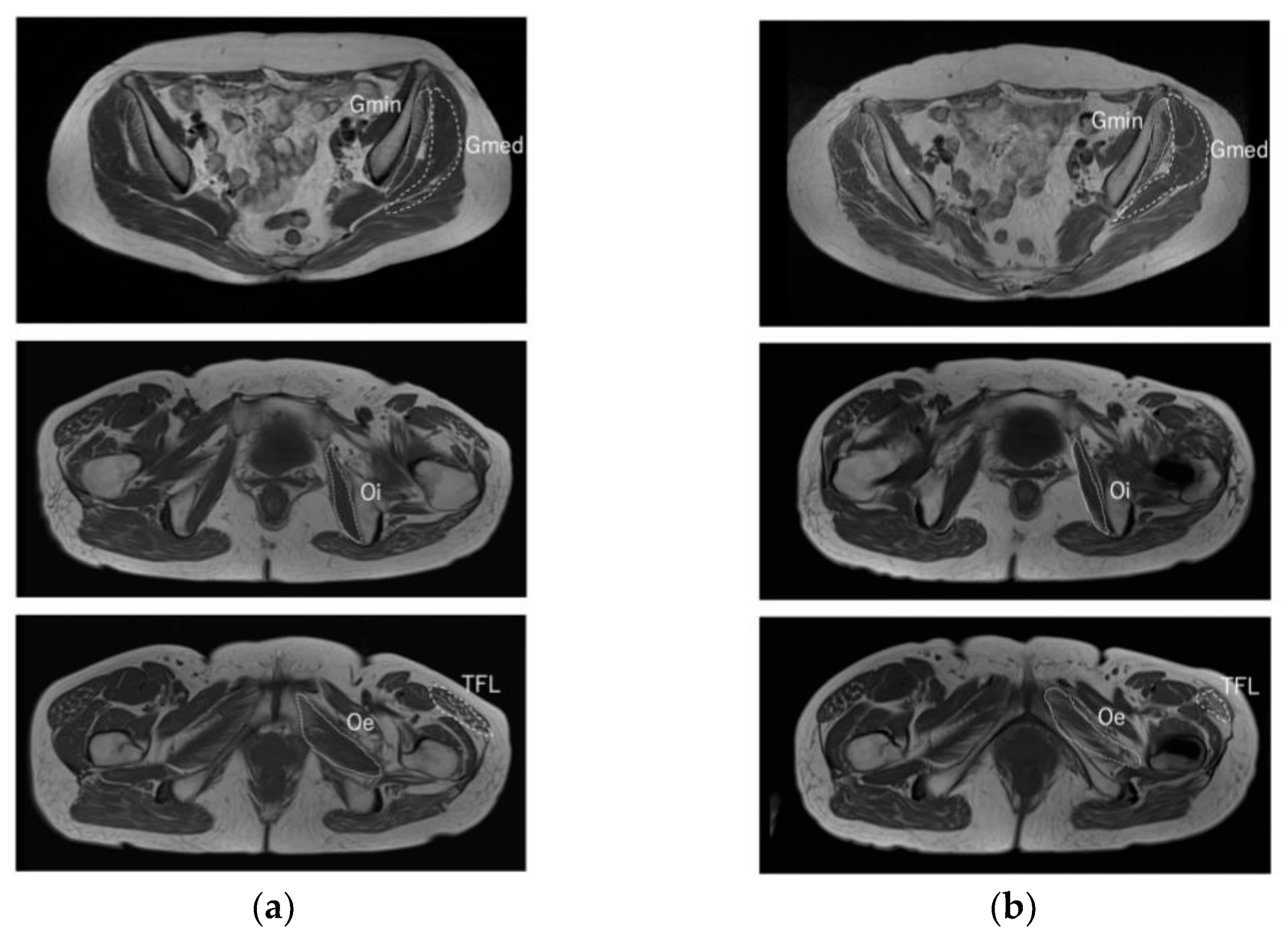 Medicina 58 00713 g006