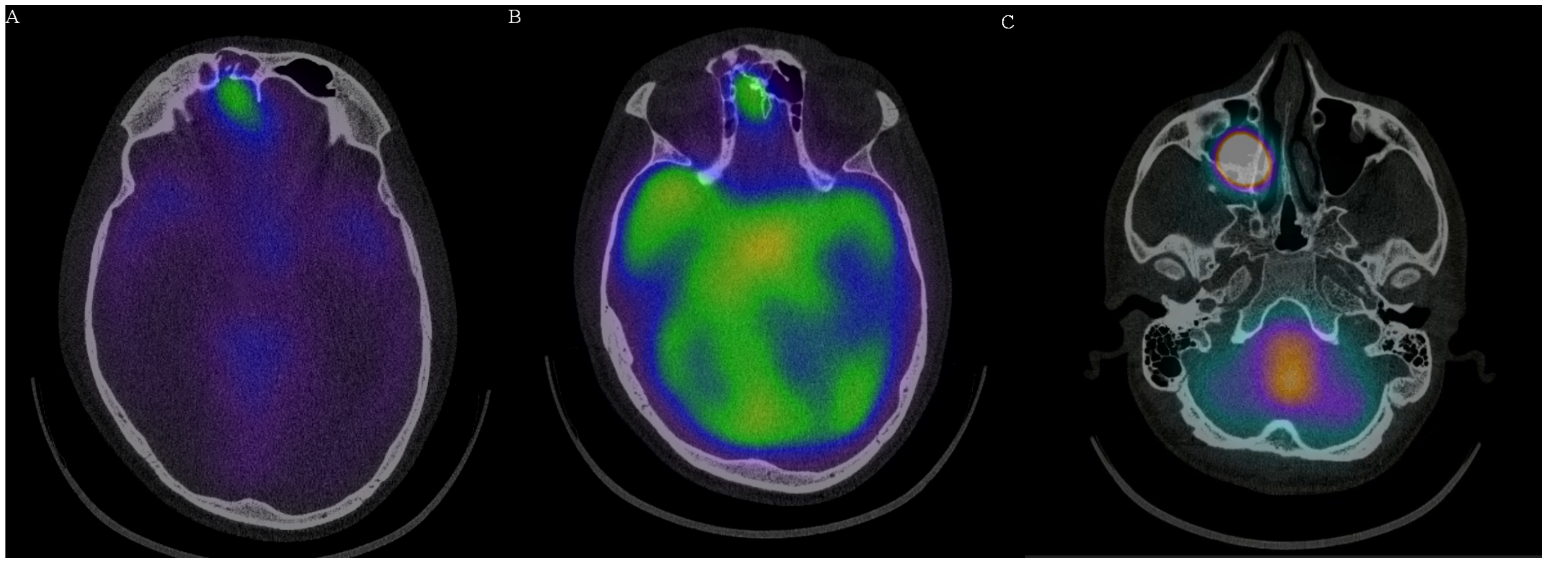 Medicina 58 00714 g003