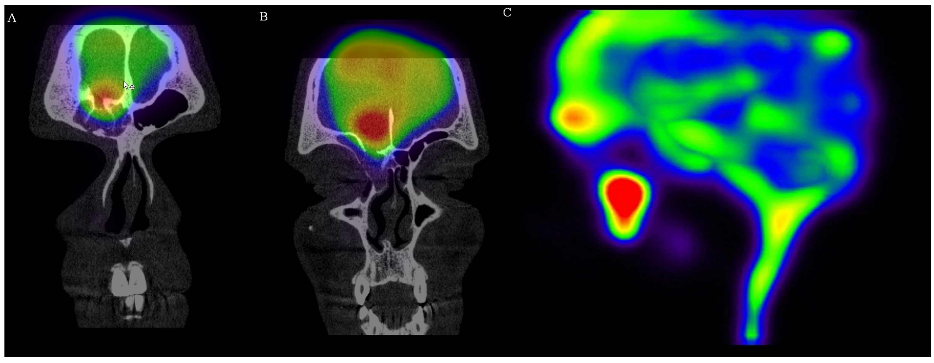 Medicina 58 00714 g004