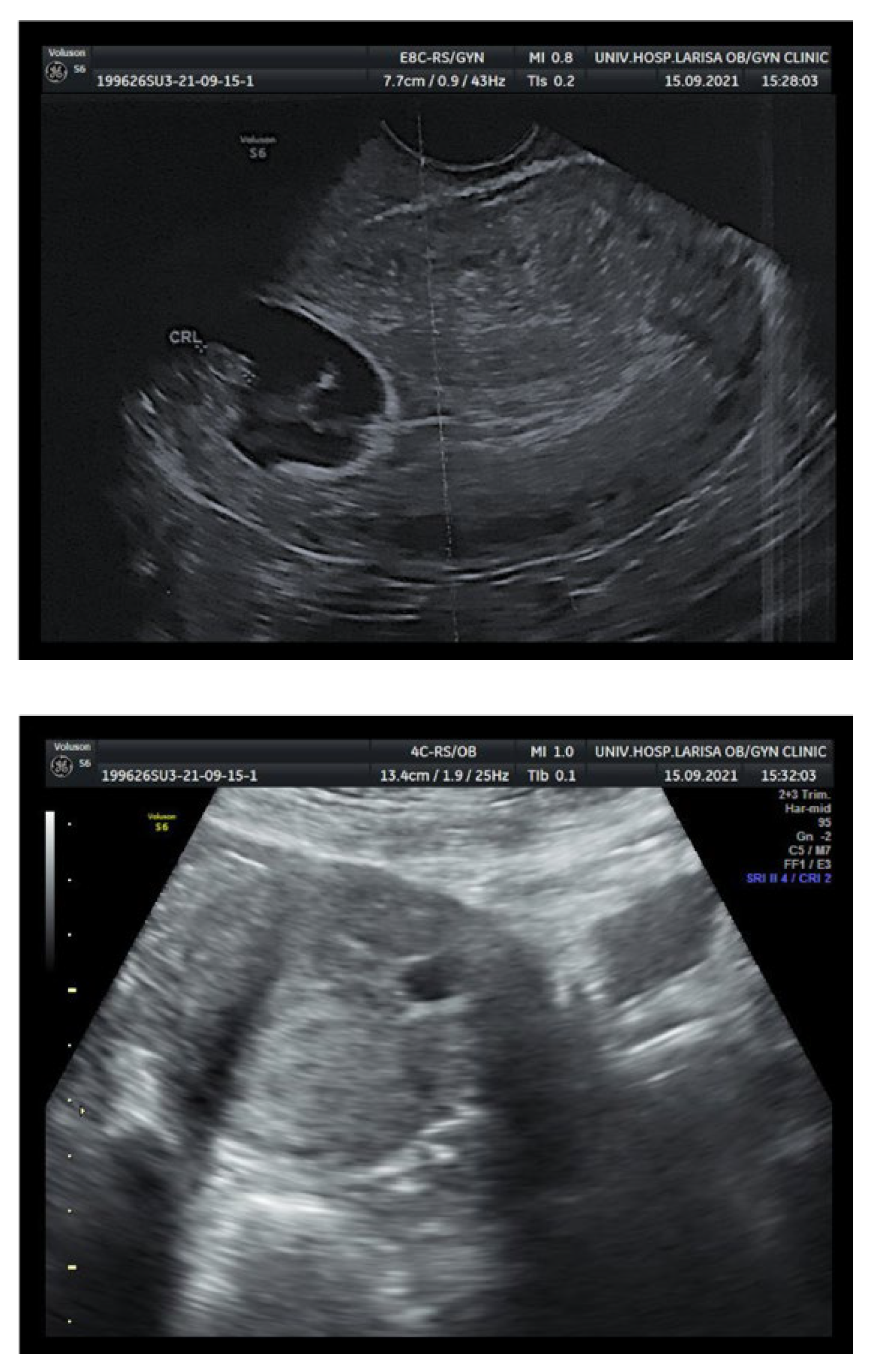 Medicina 58 00740 g001 550