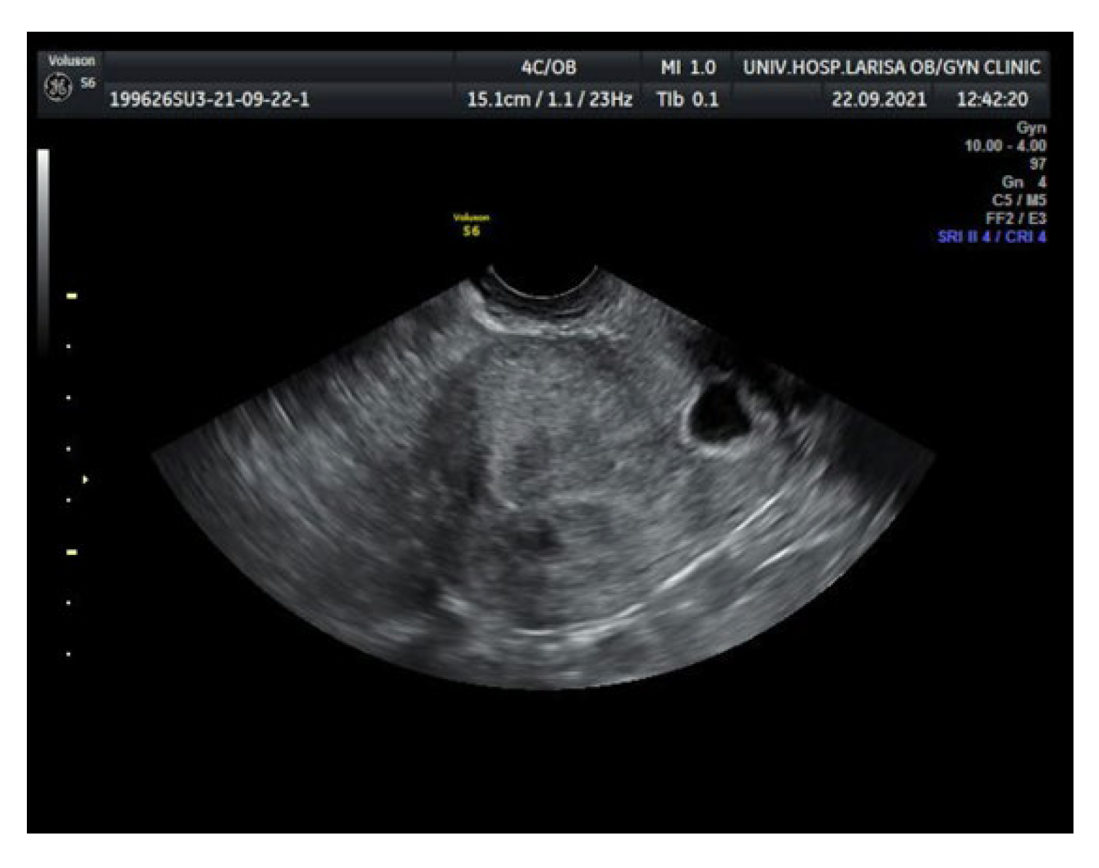 Medicina 58 00740 g002 550