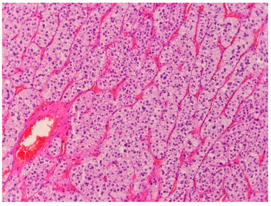 Medicina 58 00746 g002