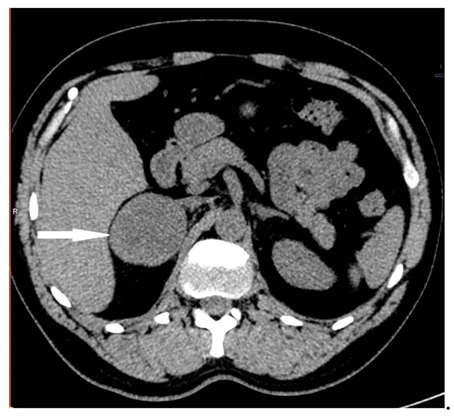 Medicina 58 00746 g003