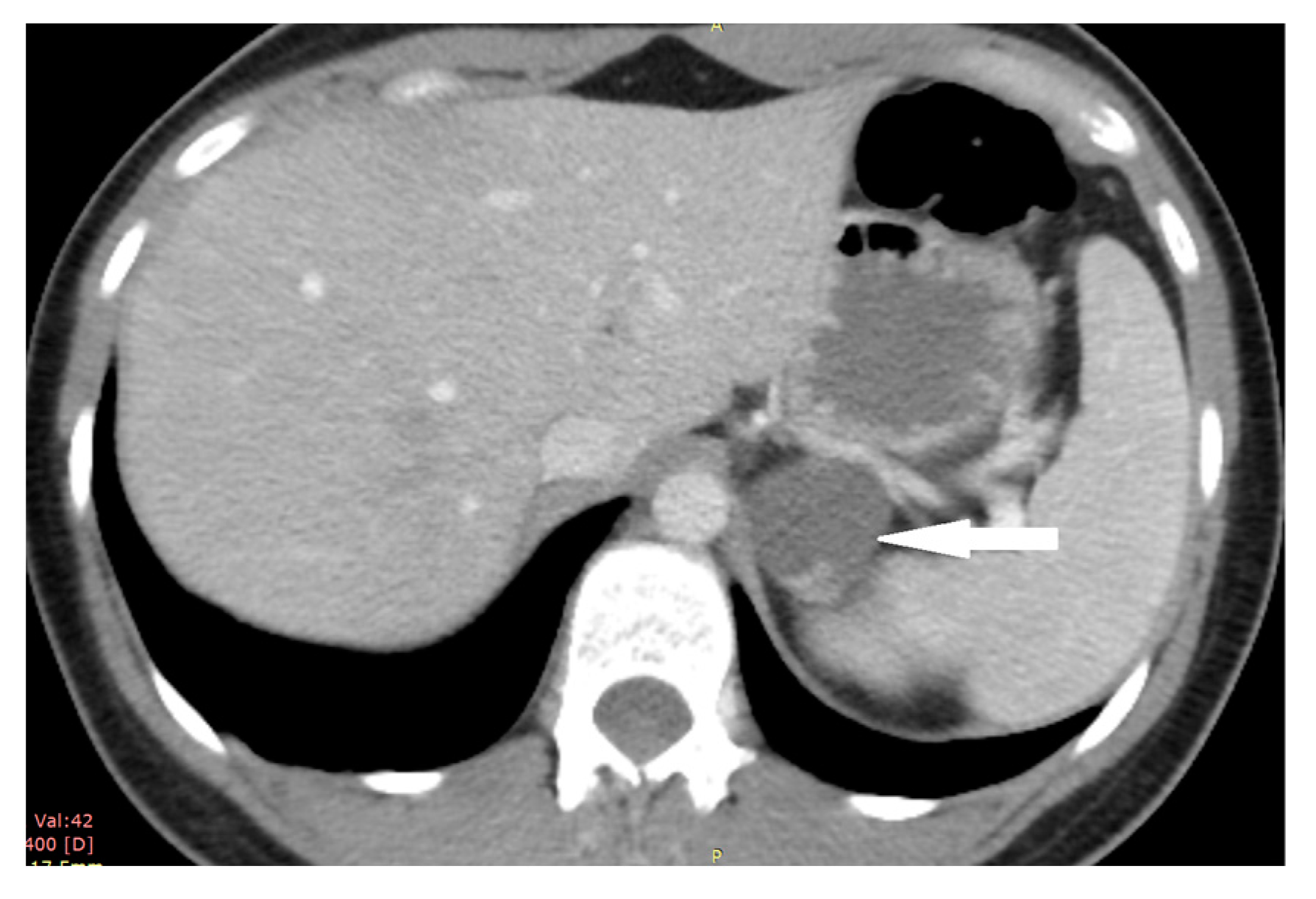 Medicina 58 00746 g008