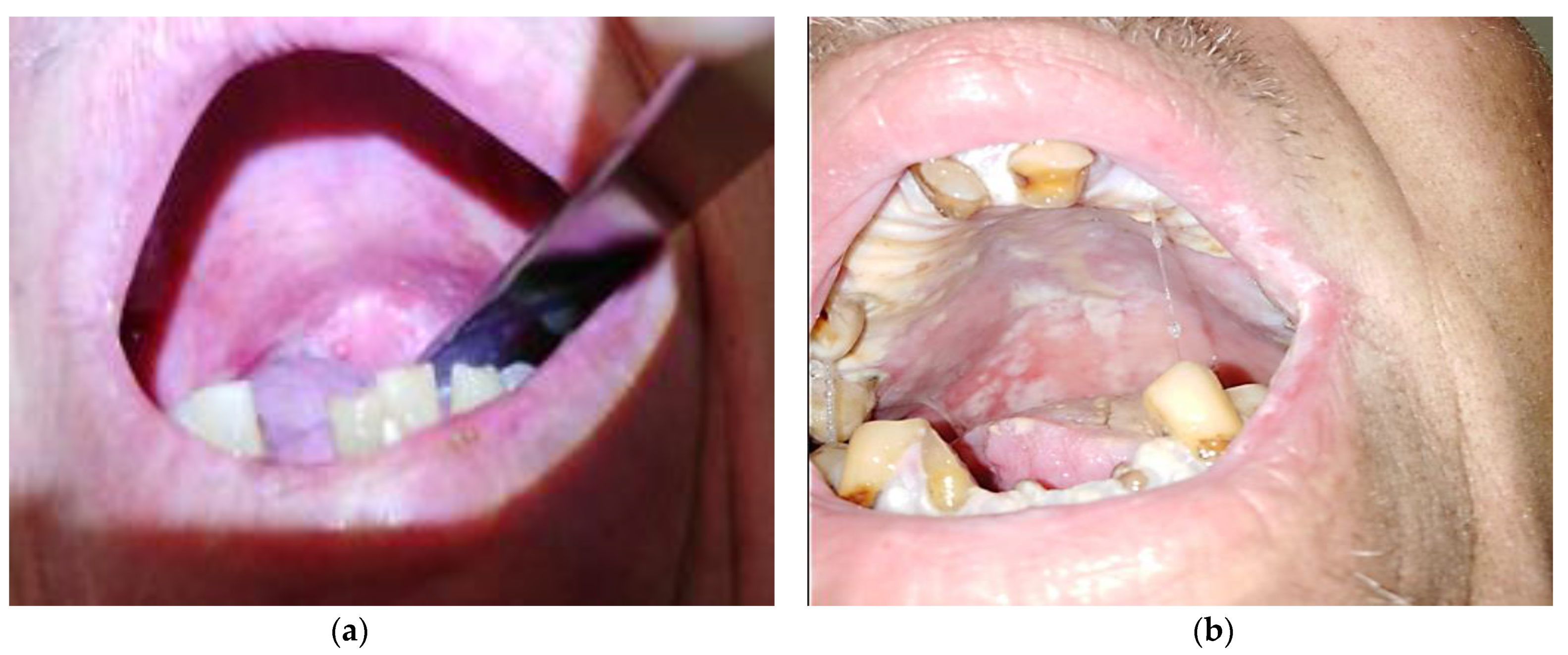 Medicina 58 00751 g002